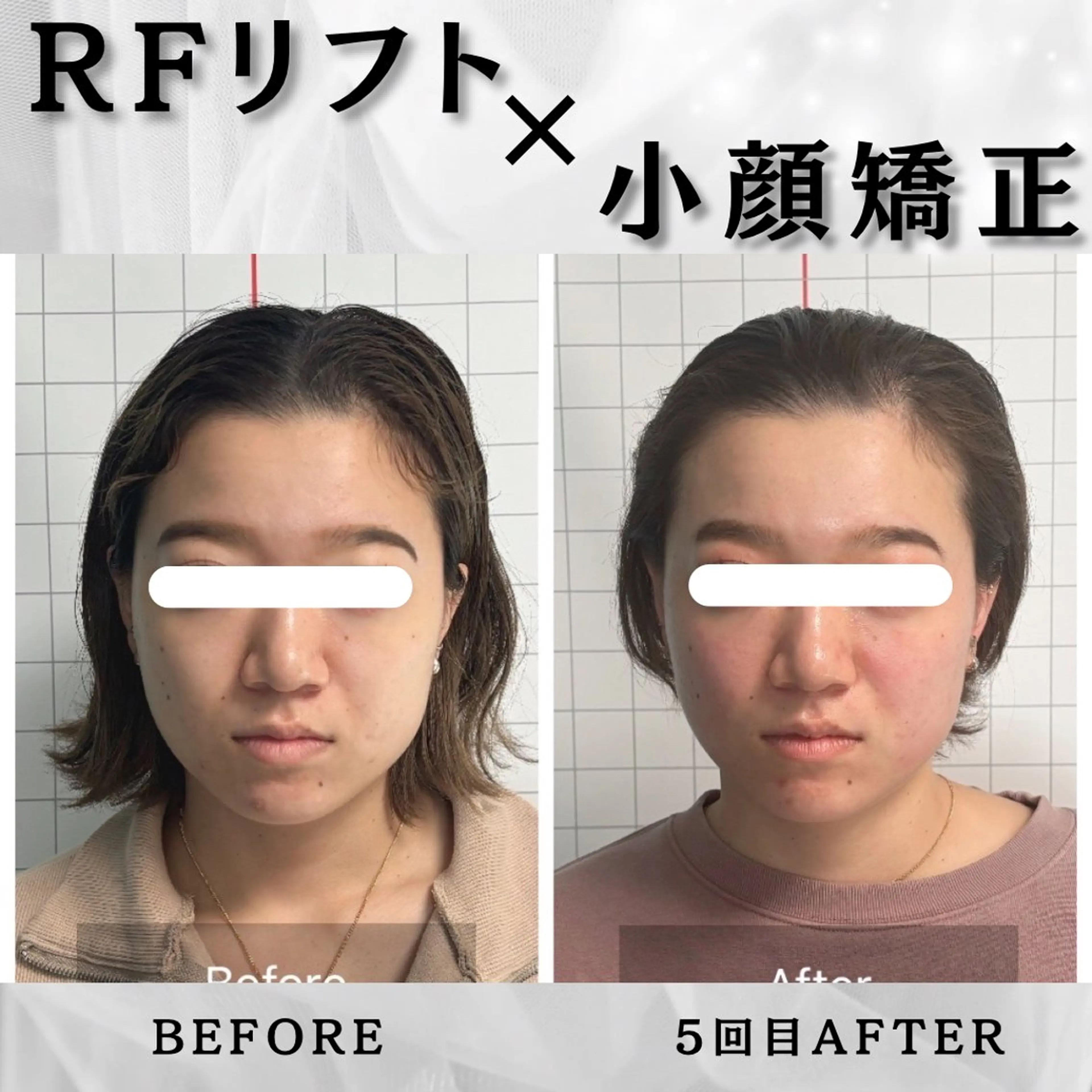 エステ リラク 小顔矯正専門店 【RED】池田のエステ・リラクイメージ