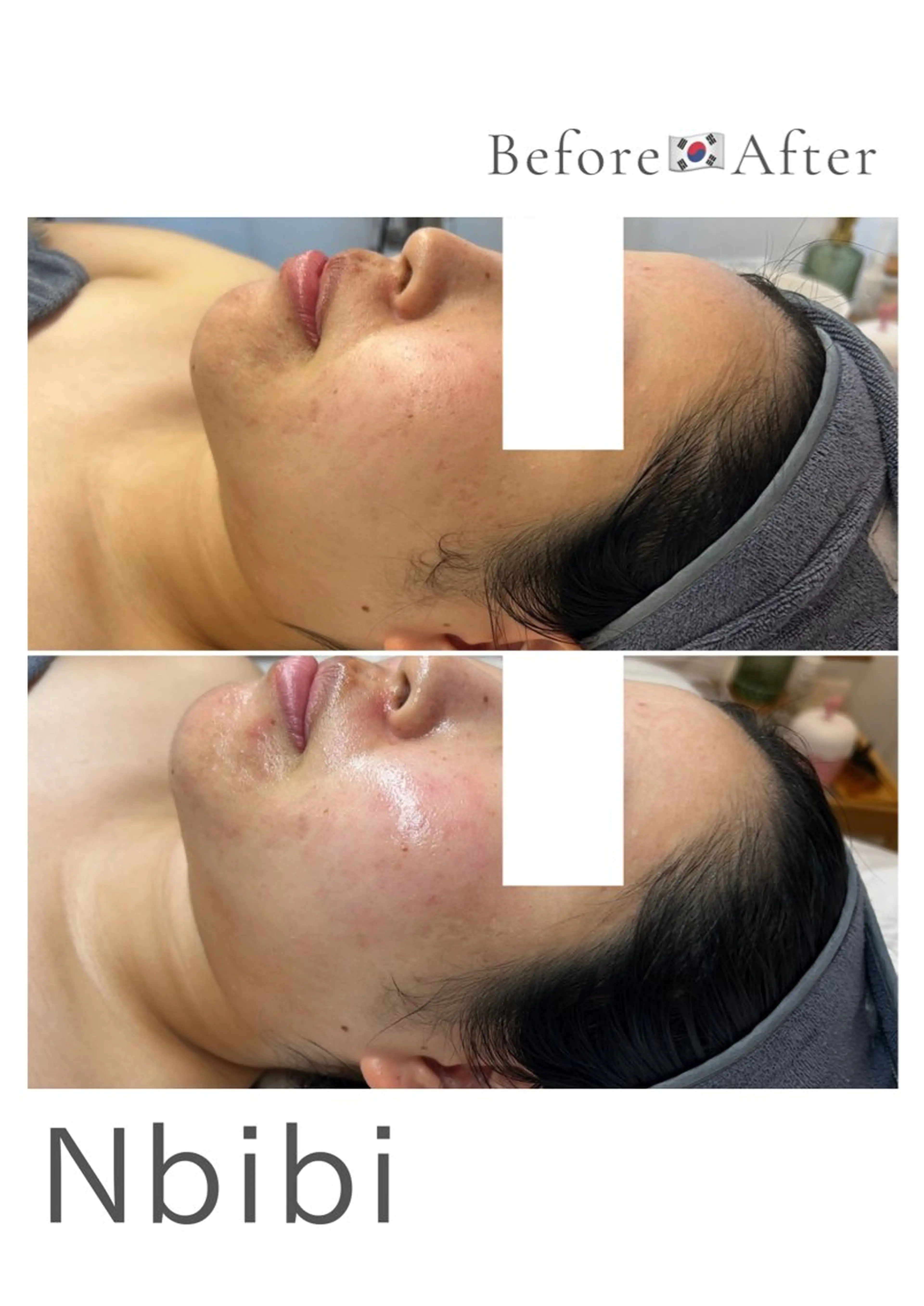 韓国🇰🇷価格 サロン_Nbibiのエステ・リラクイメージ