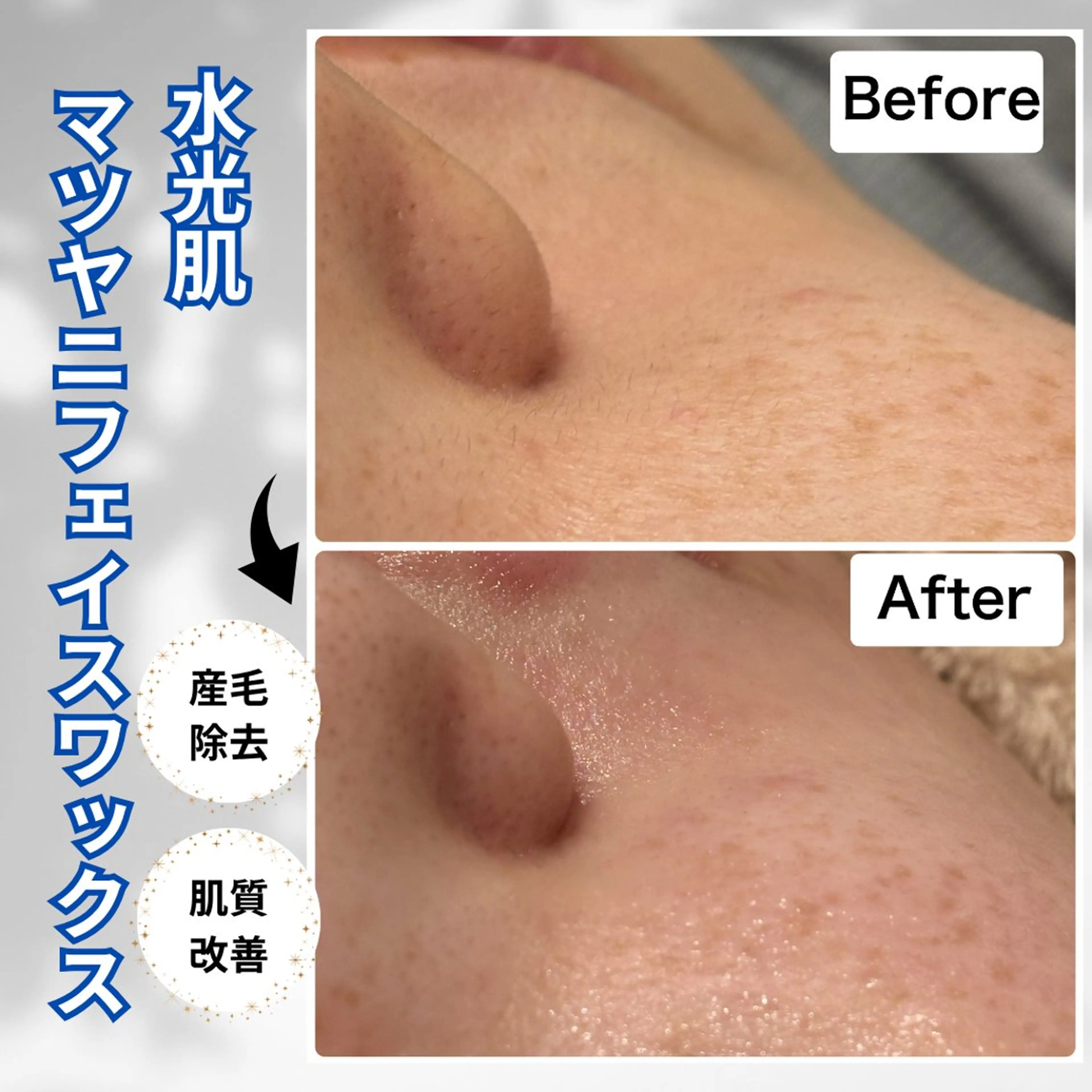 エステ 美肌脱毛サロン muroのエステ・リラクイメージ