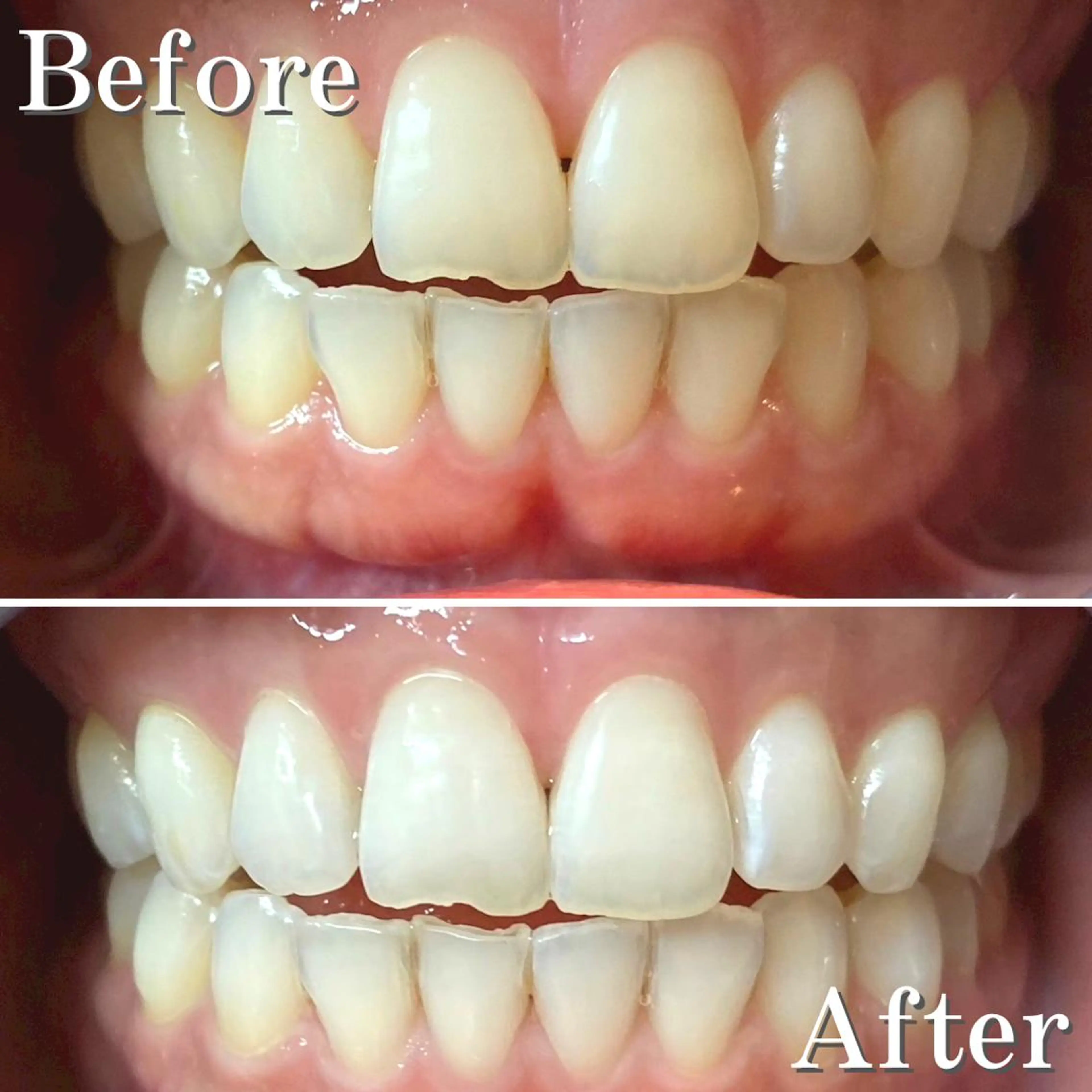 カラー パーマ ヘアアレンジ メンズ ネイル マツエク・マツパ アイブロウ 結婚式・ブライダル メンズアイブロウ 結婚式・ブライダル メンズネイル ブライダルネイル LBSホワイトニング 銀座店💎公式のその他イメージ