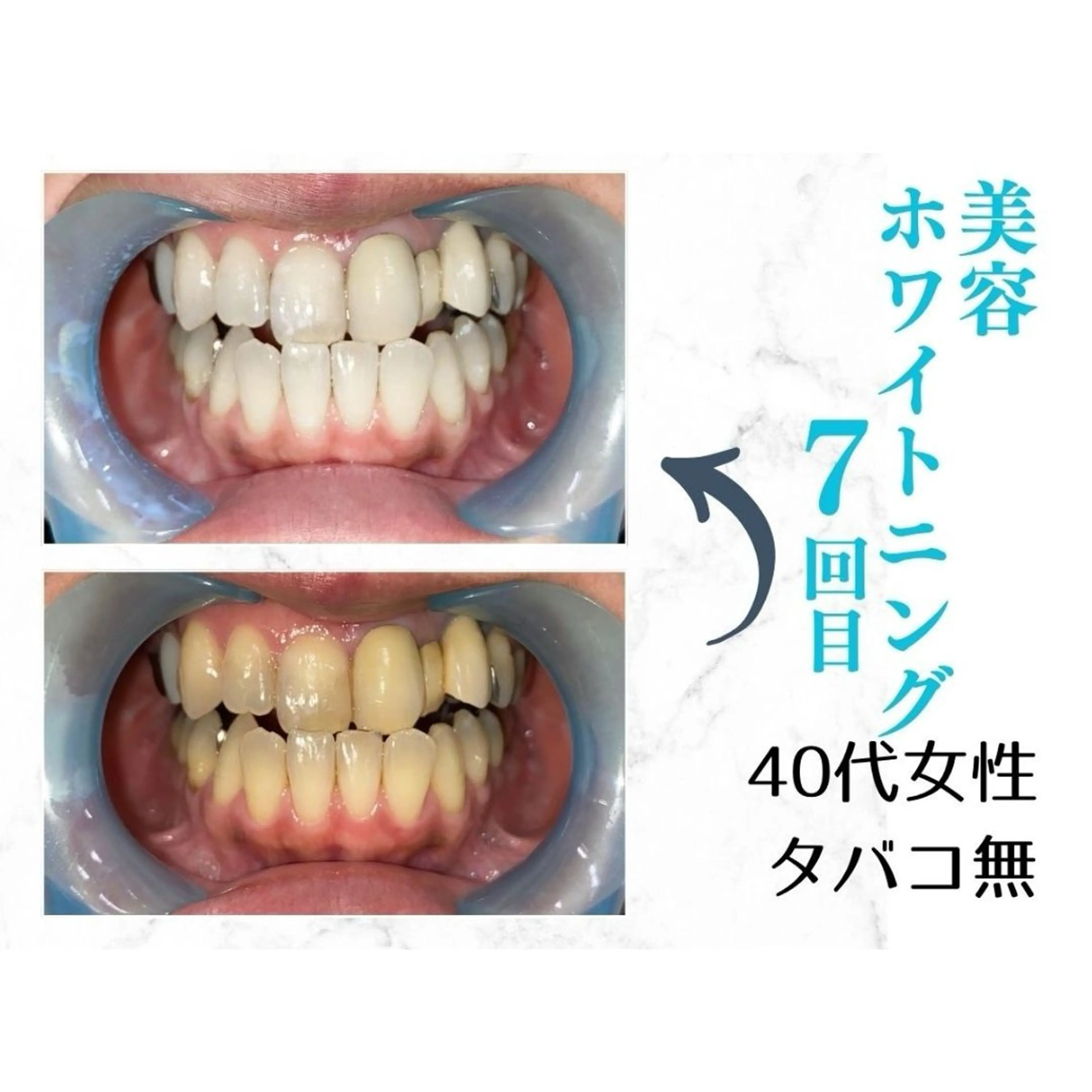 ホワイトニングサロン le  canonのその他イメージ