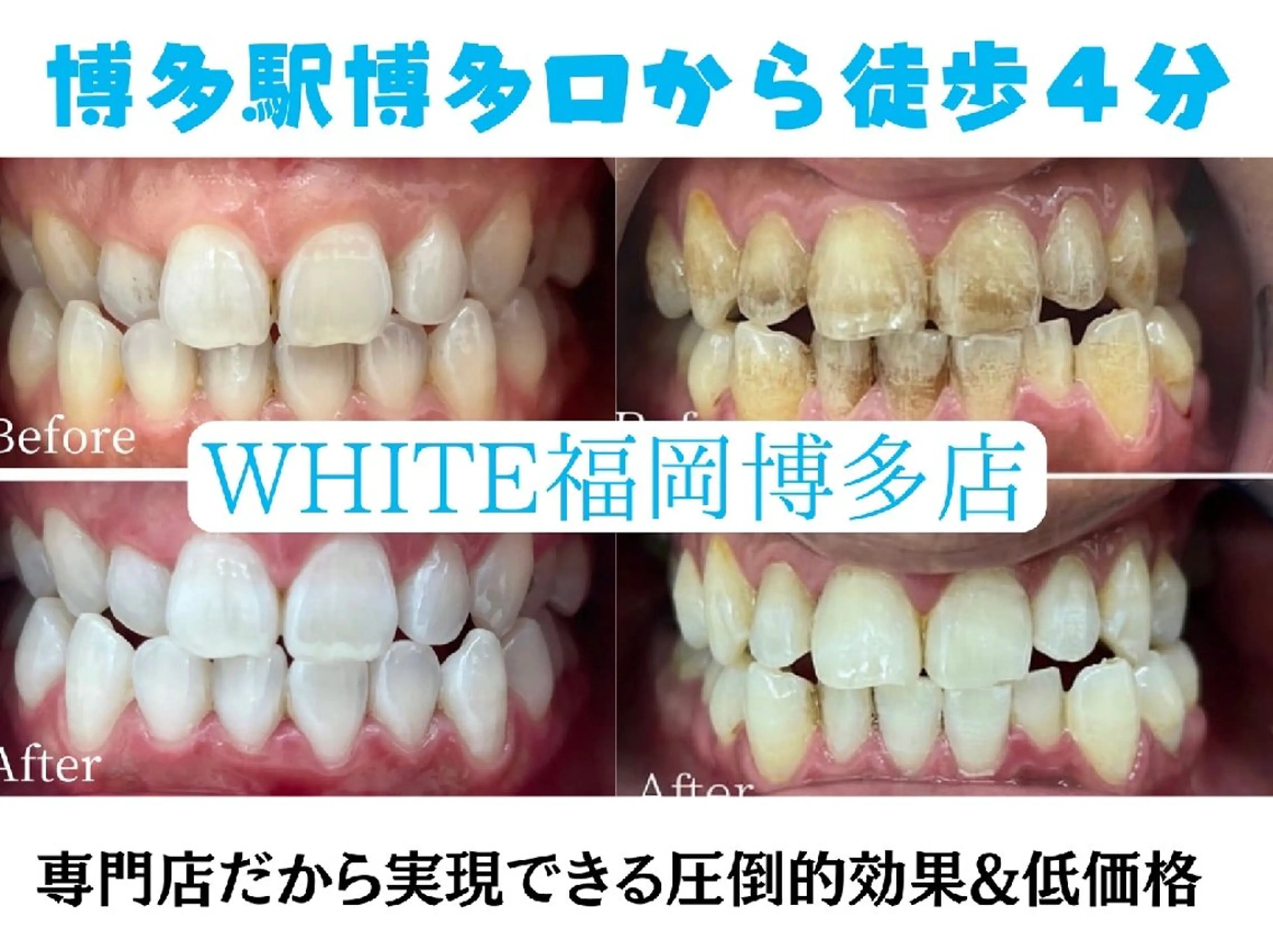 メンズ セルフホワイトニング WHITE福岡博多店のエステ・リラクイメージ