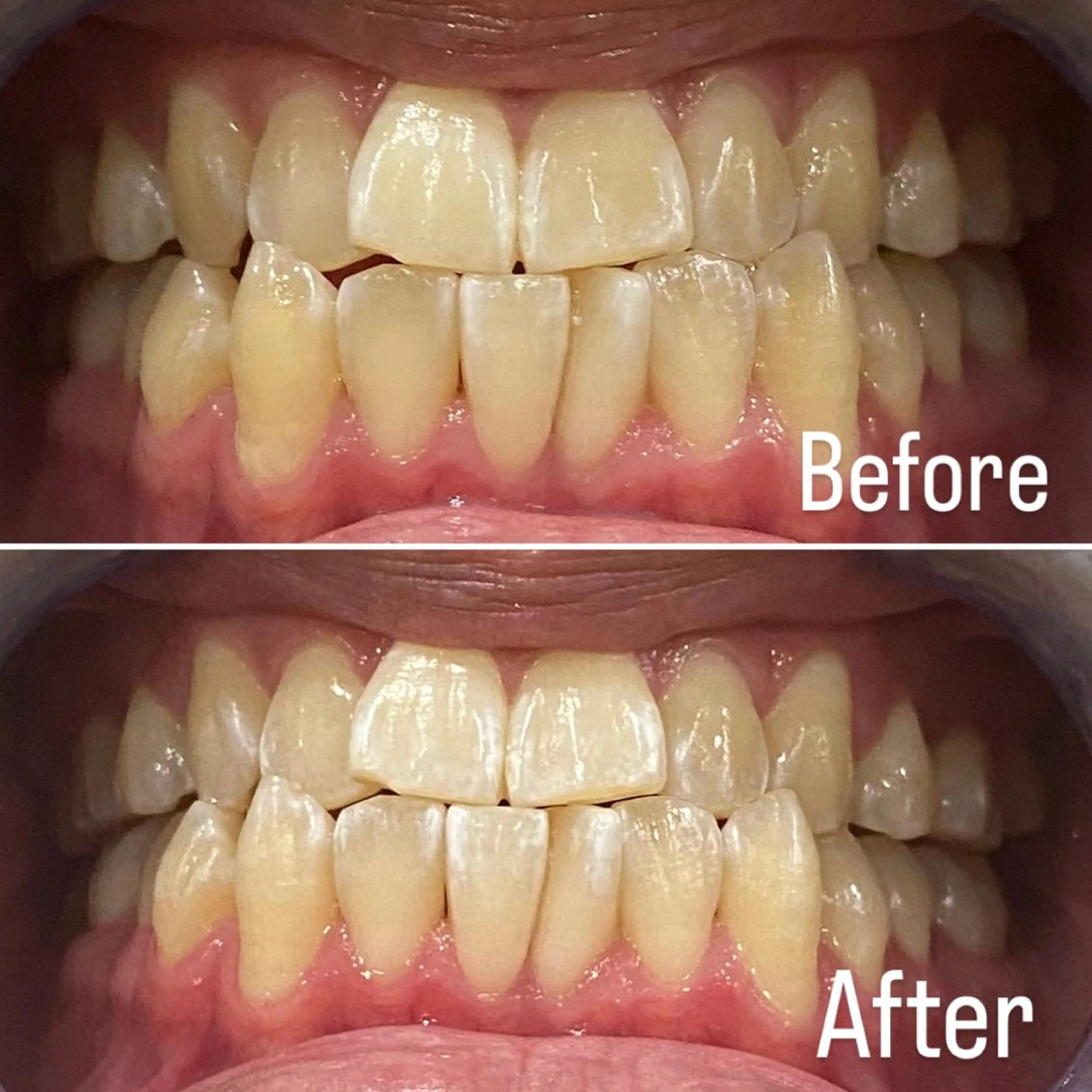 メンズ その他 whiteclub.THREE福島店所属・whiteclub THREEのその他イメージ