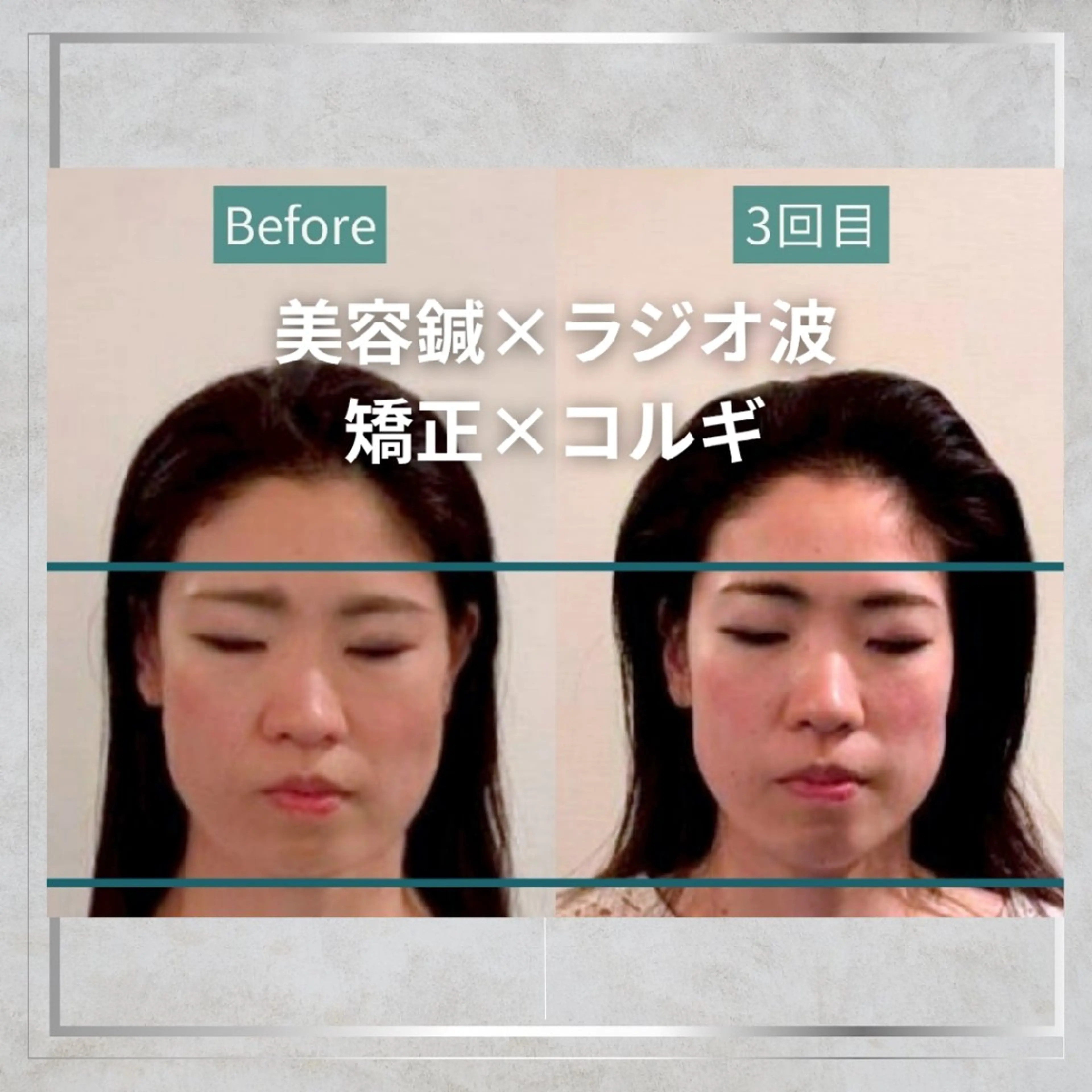 エステ リラク KANWA鍼灸院所属・KANWA 鍼灸院のエステ・リラクイメージ