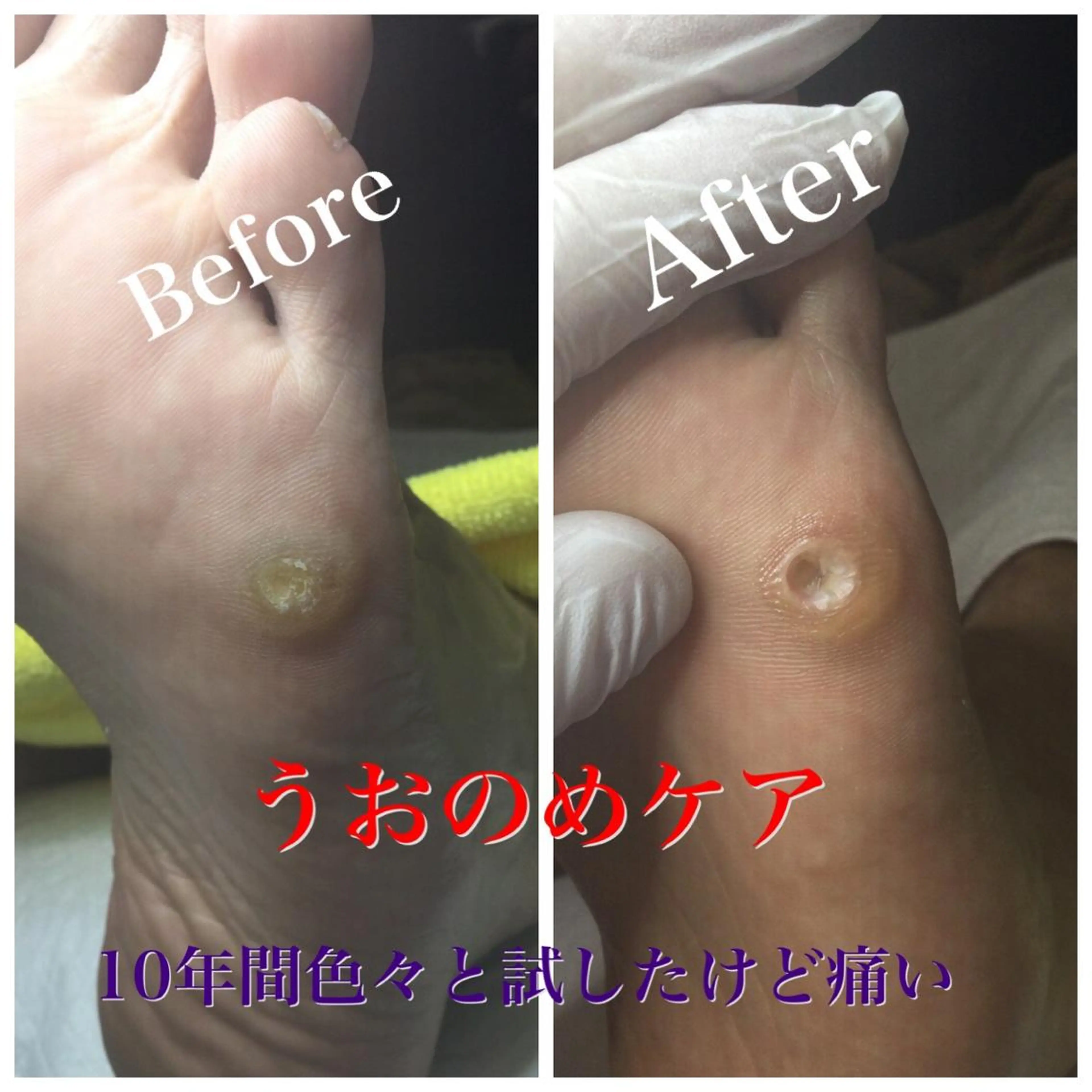 メンズ その他 ドクターネイル爪革命 takahashiのその他イメージ