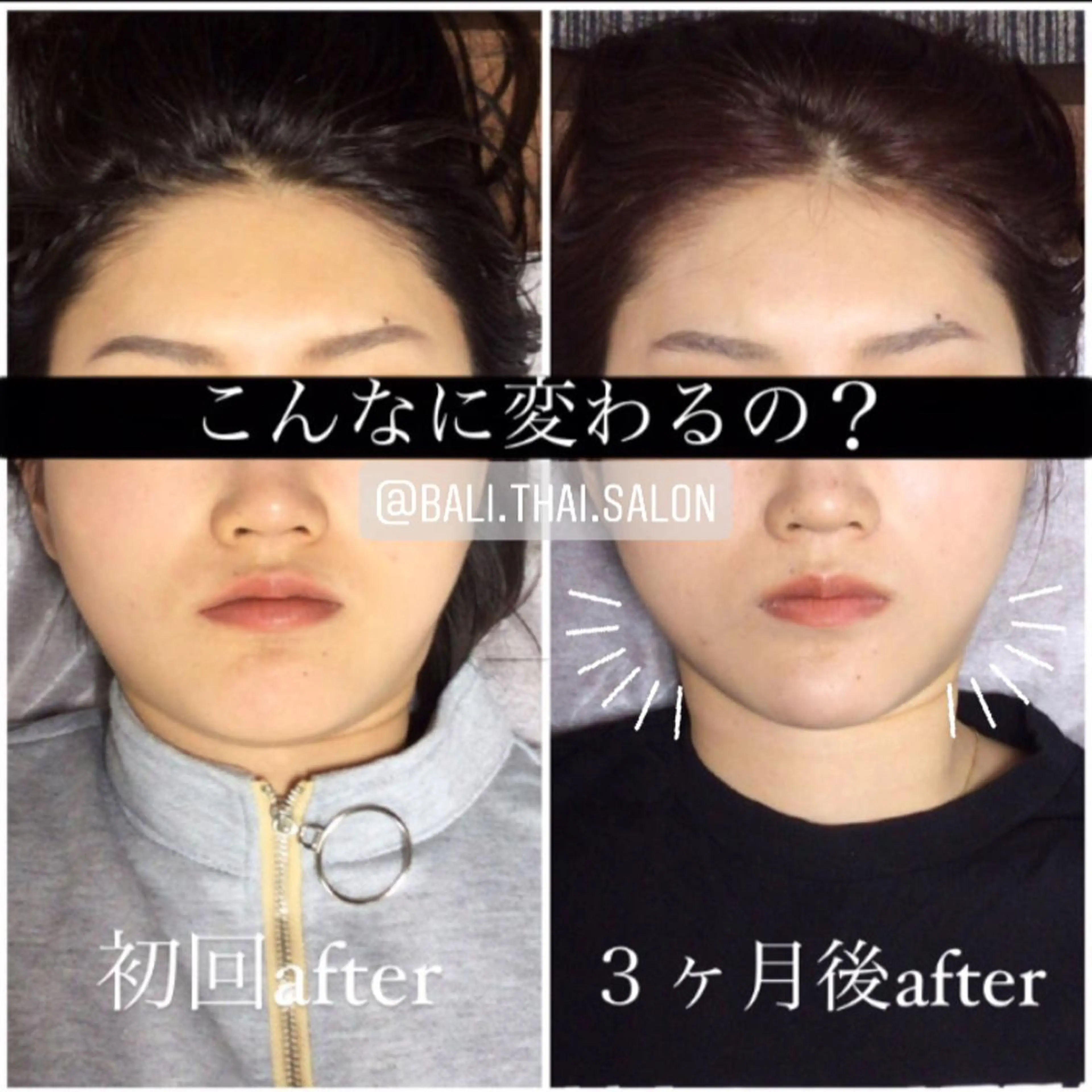 エステ リラク 🌈歪み改善🌈 バリンタイ すぎうらのエステ・リラクイメージ