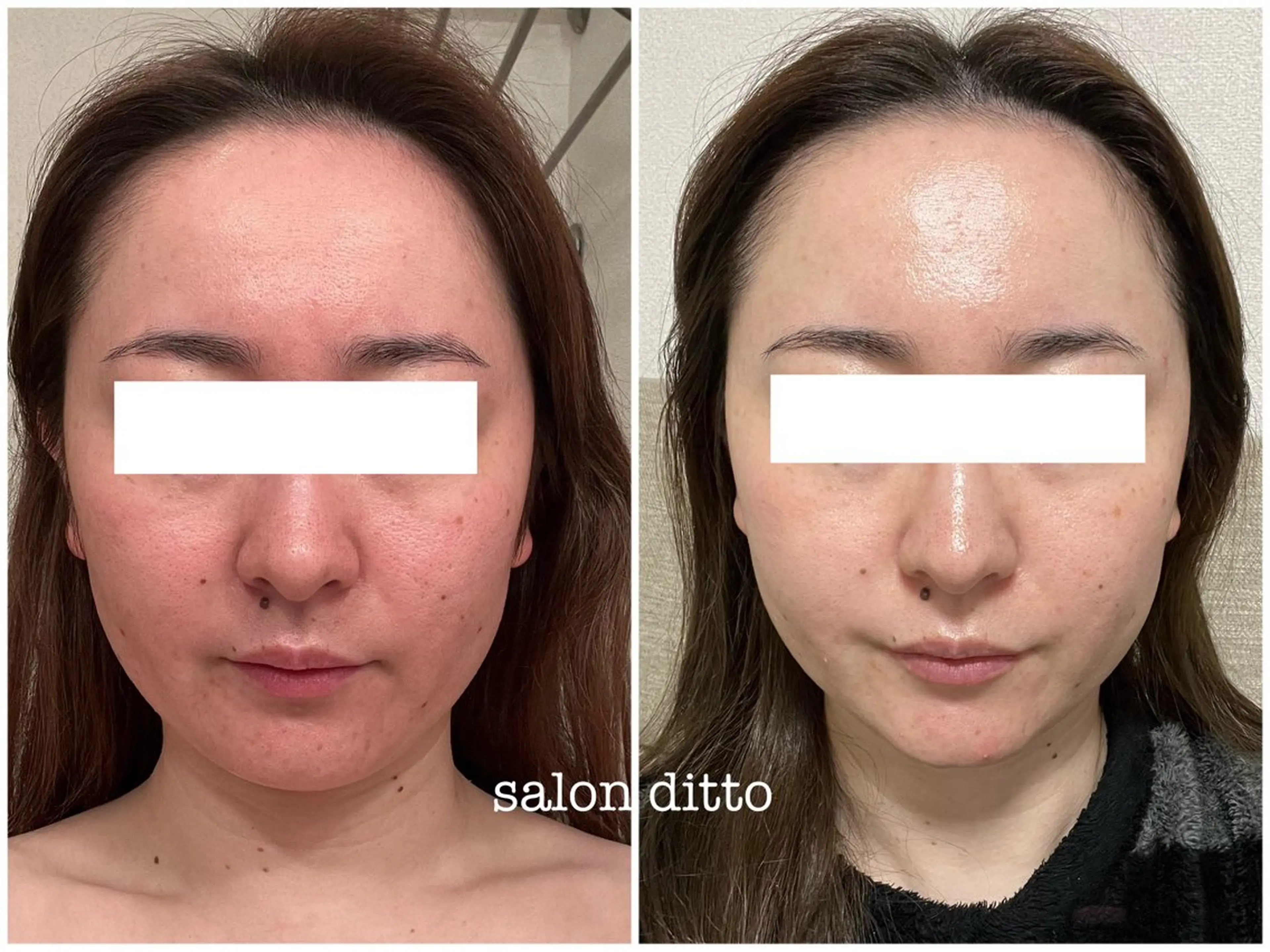 エステ リラク salon ditto所属・mio (小顔・ヘッドスパ)のエステ・リラクイメージ