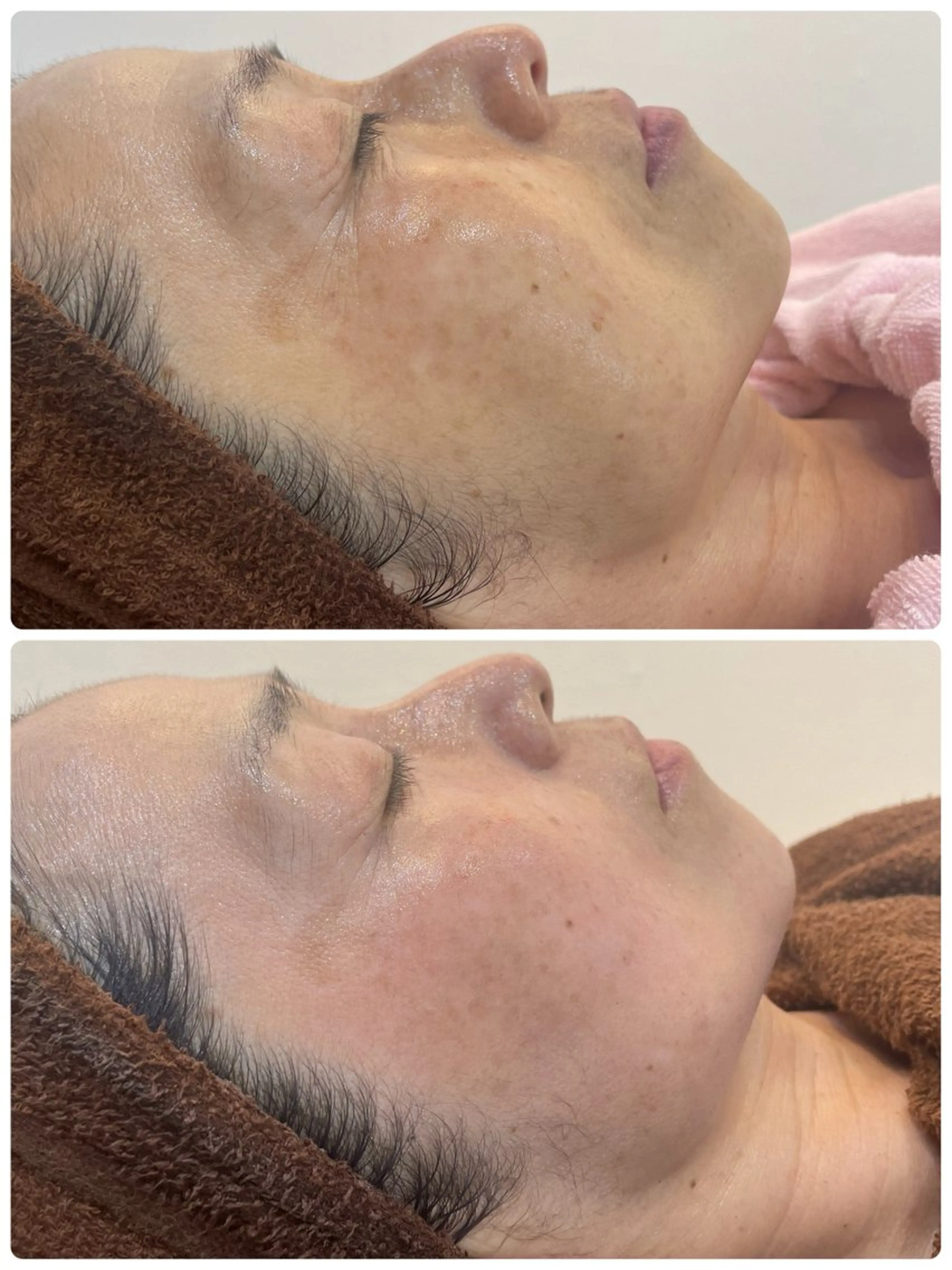 パーソナル肌質改善 🦋APRI🅿️有のエステ・リラクイメージ