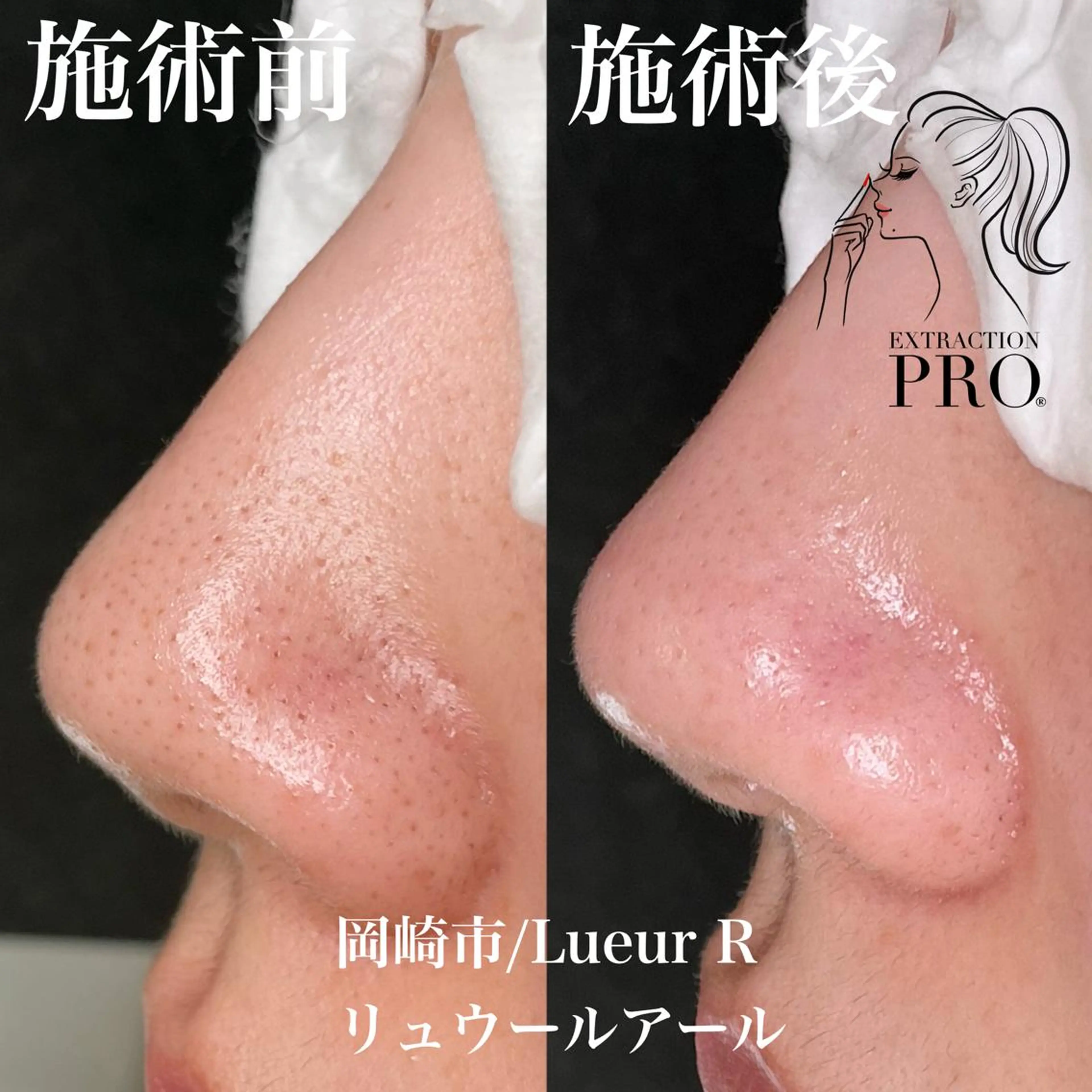 エステ 大久保 里奈のエステ・リラクイメージ