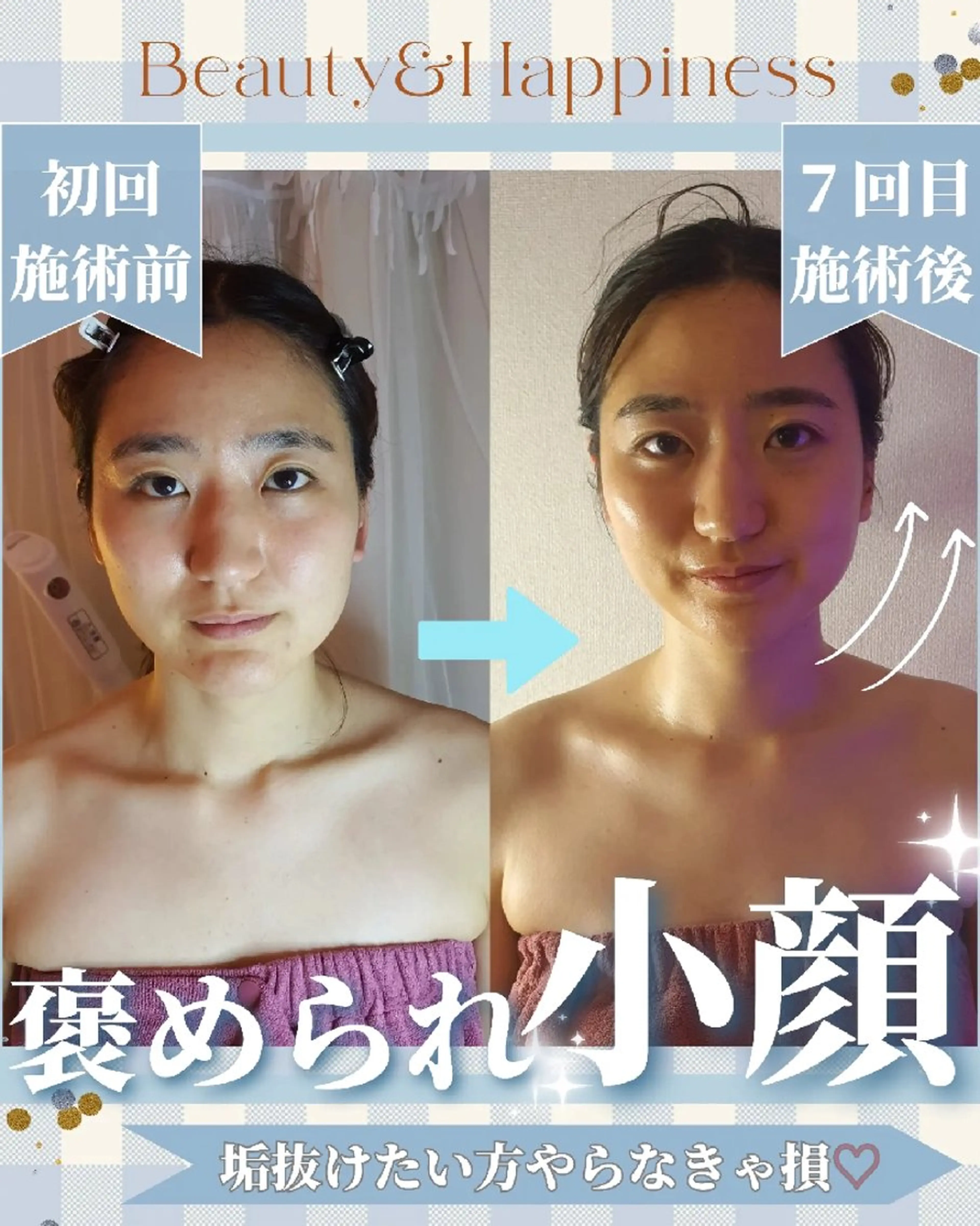 人気No.3🥇【🎄Xmas特価✨】瞬間☆小顔美人💖筋膜リリース┃韓国小顔┃二重あご撃退┃むくみ┃丸顔卒業の写真