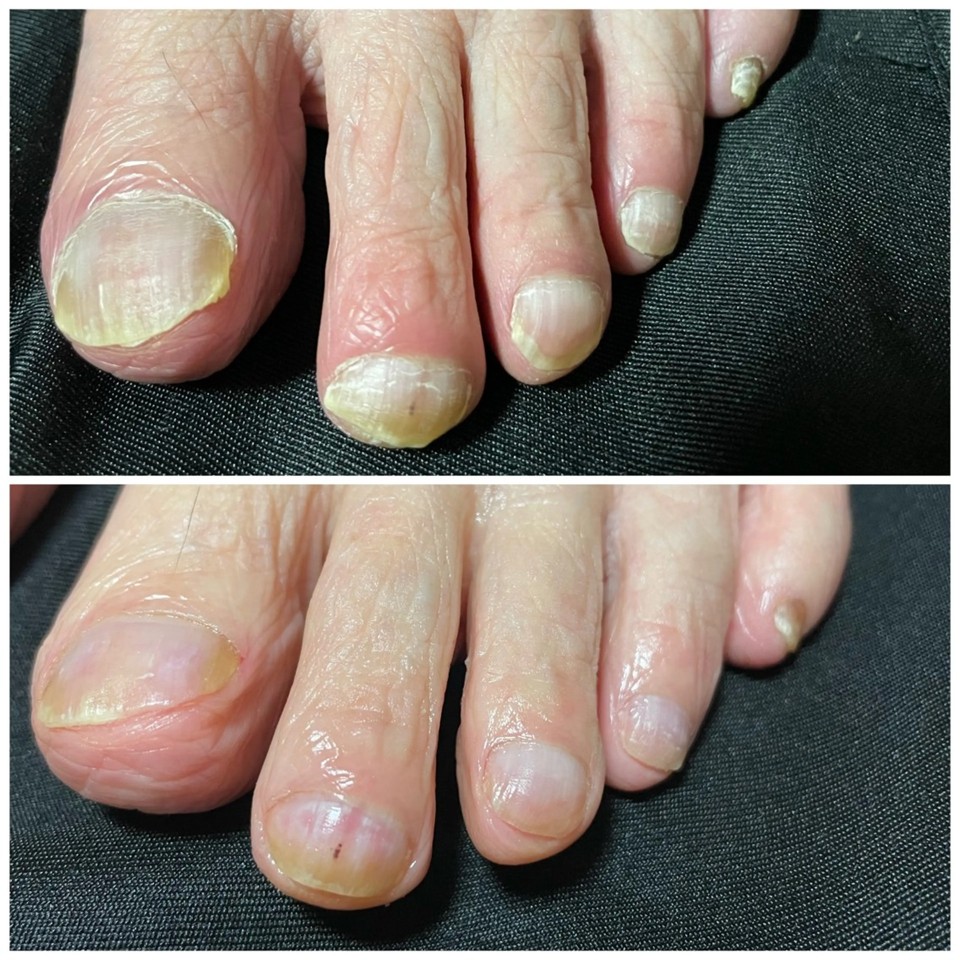 LIZERA&CO（charitesfam内）所属・南古谷　松本 かよのネイルデザイン