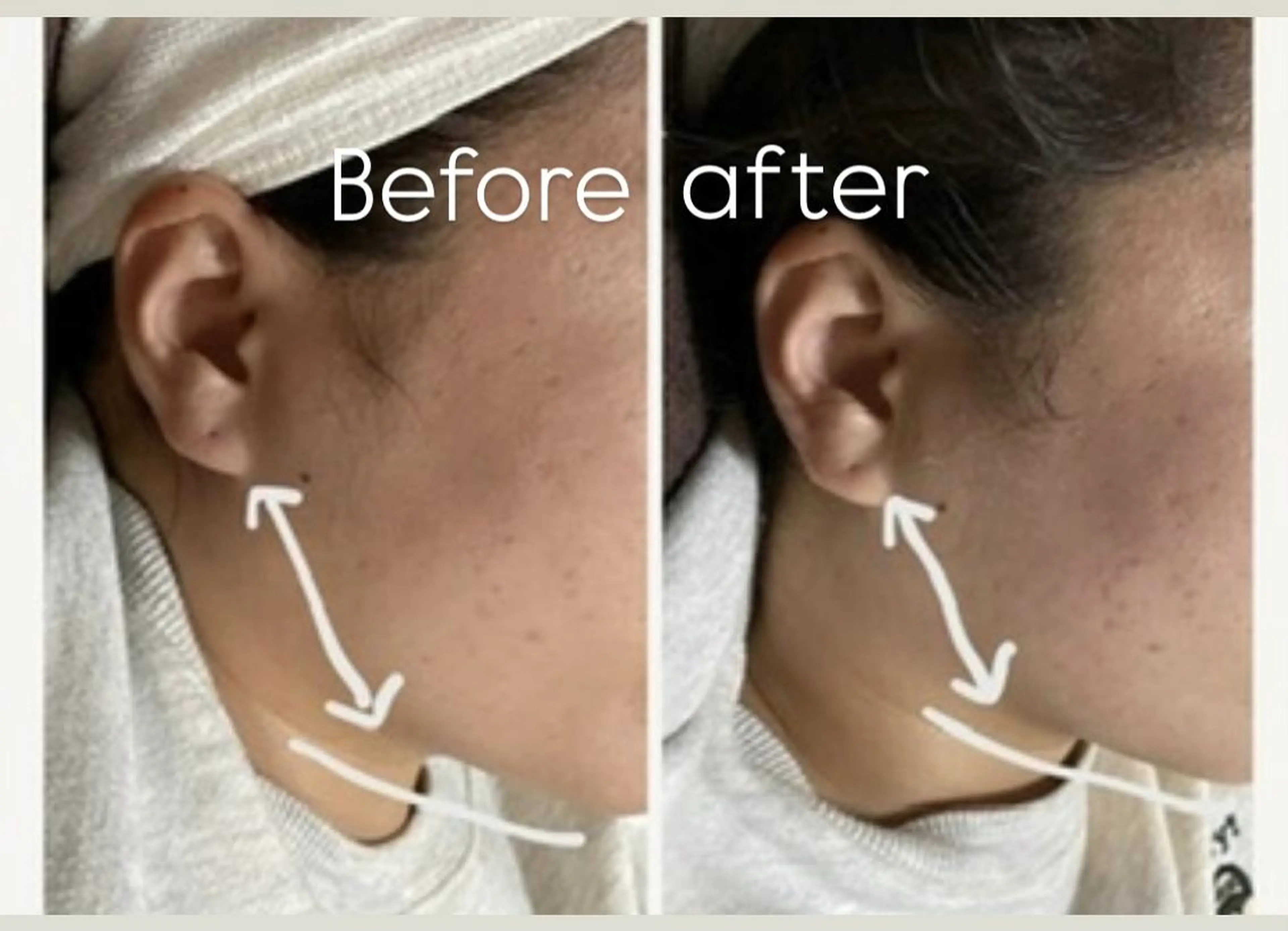 エステ NICOLAUGH/ 村松【小顔.ボディ】のエステ・リラクイメージ