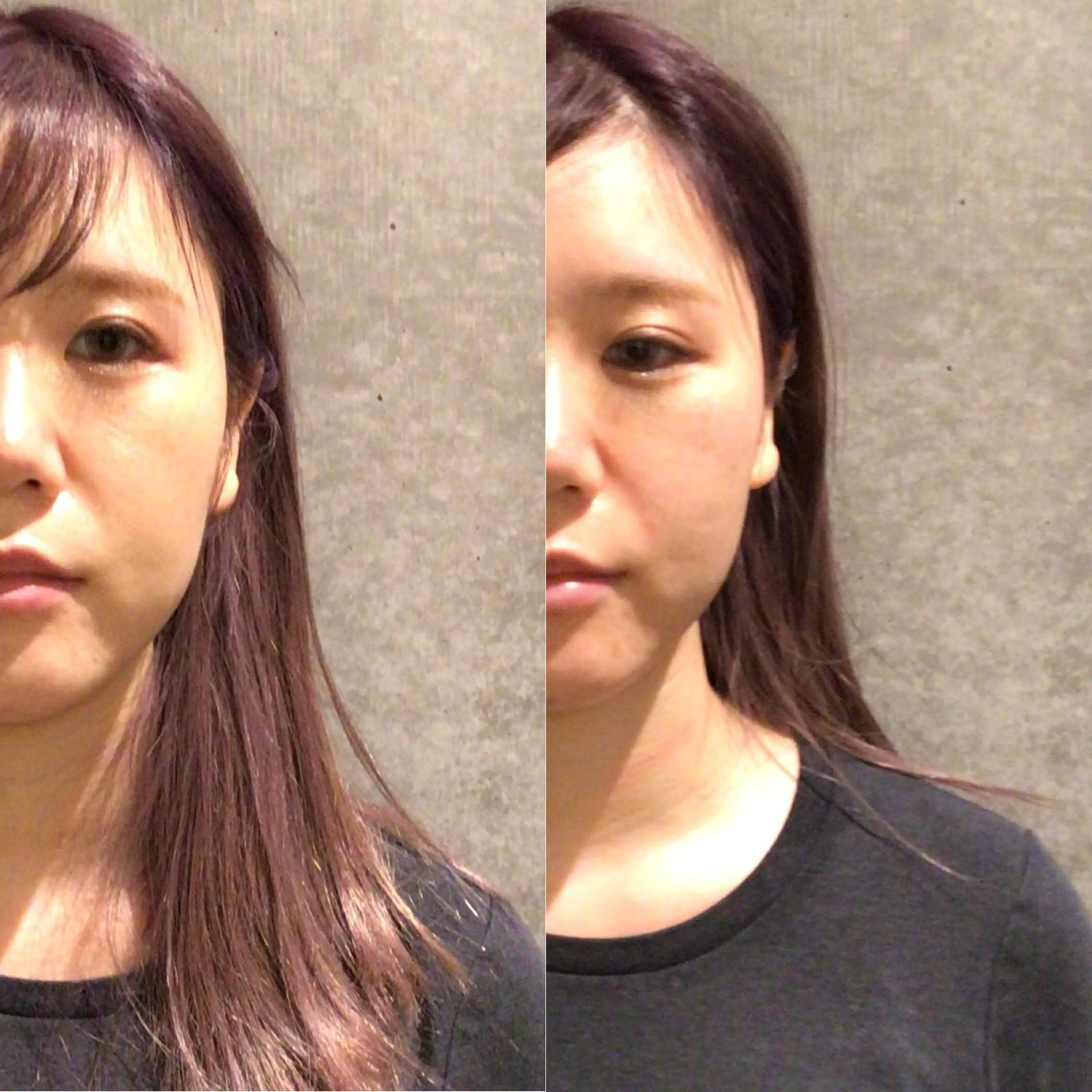 目黒/小顔/骨盤/ 美容鍼/美顔鍼/小林のエステ・リラクイメージ