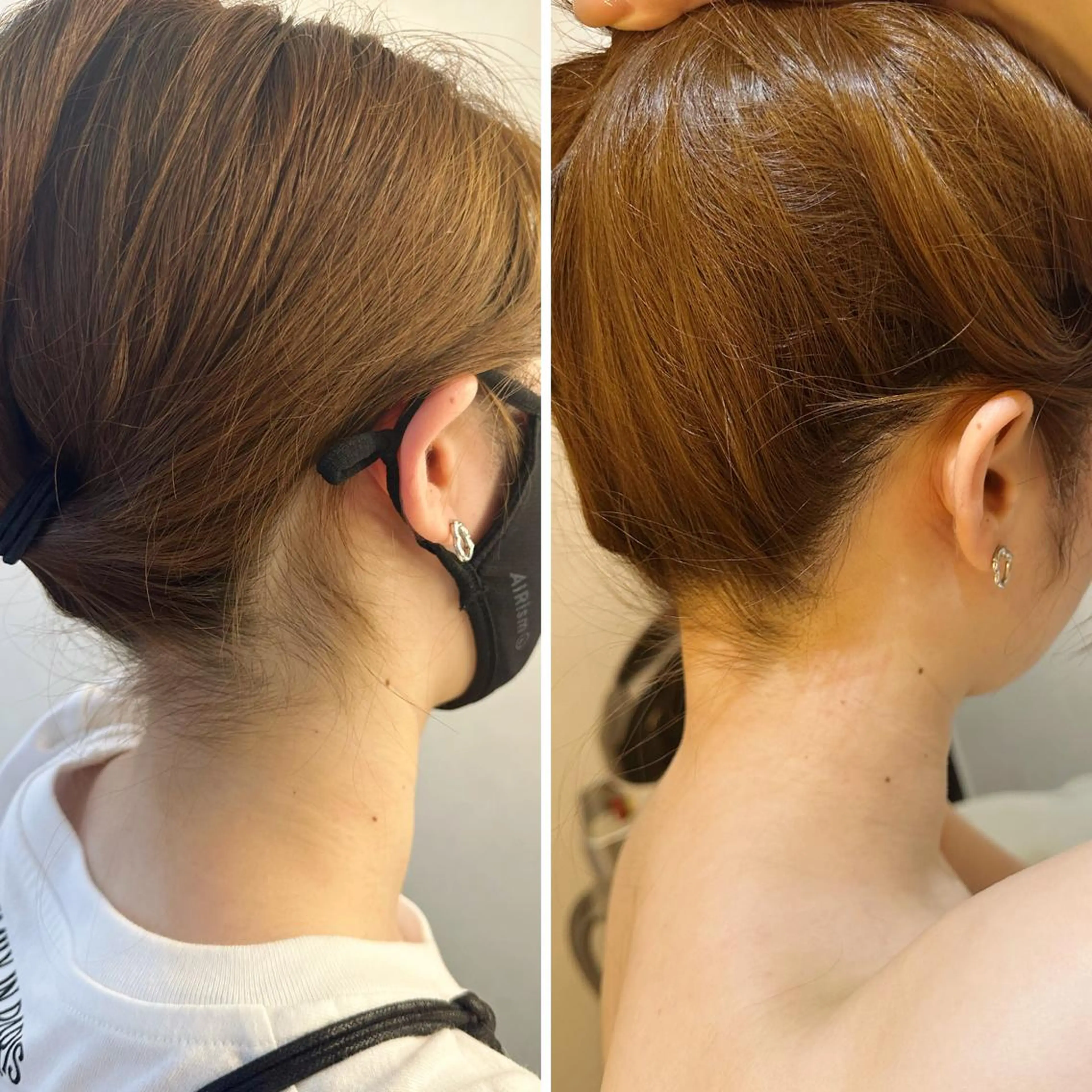 脱毛 うなじ脱毛/美肌脱毛 LABELのエステ・リラクイメージ