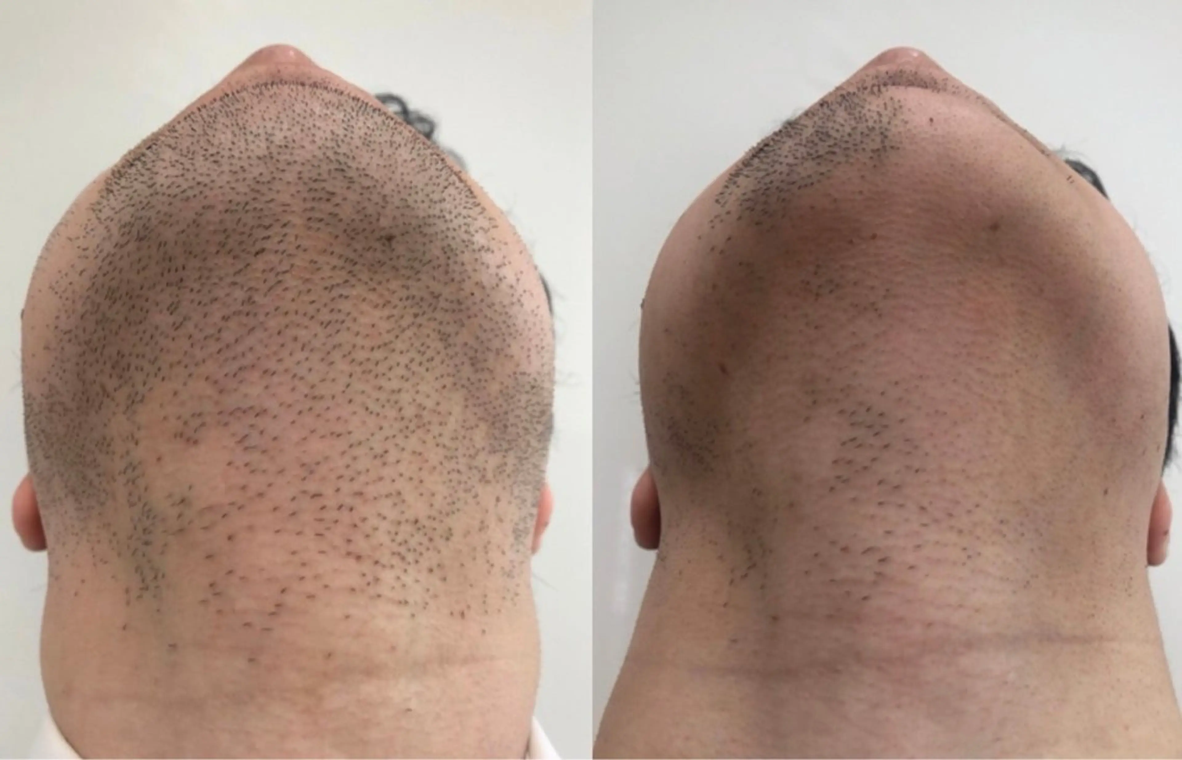 ボヌール ビューティサロンのエステ・リラクイメージ