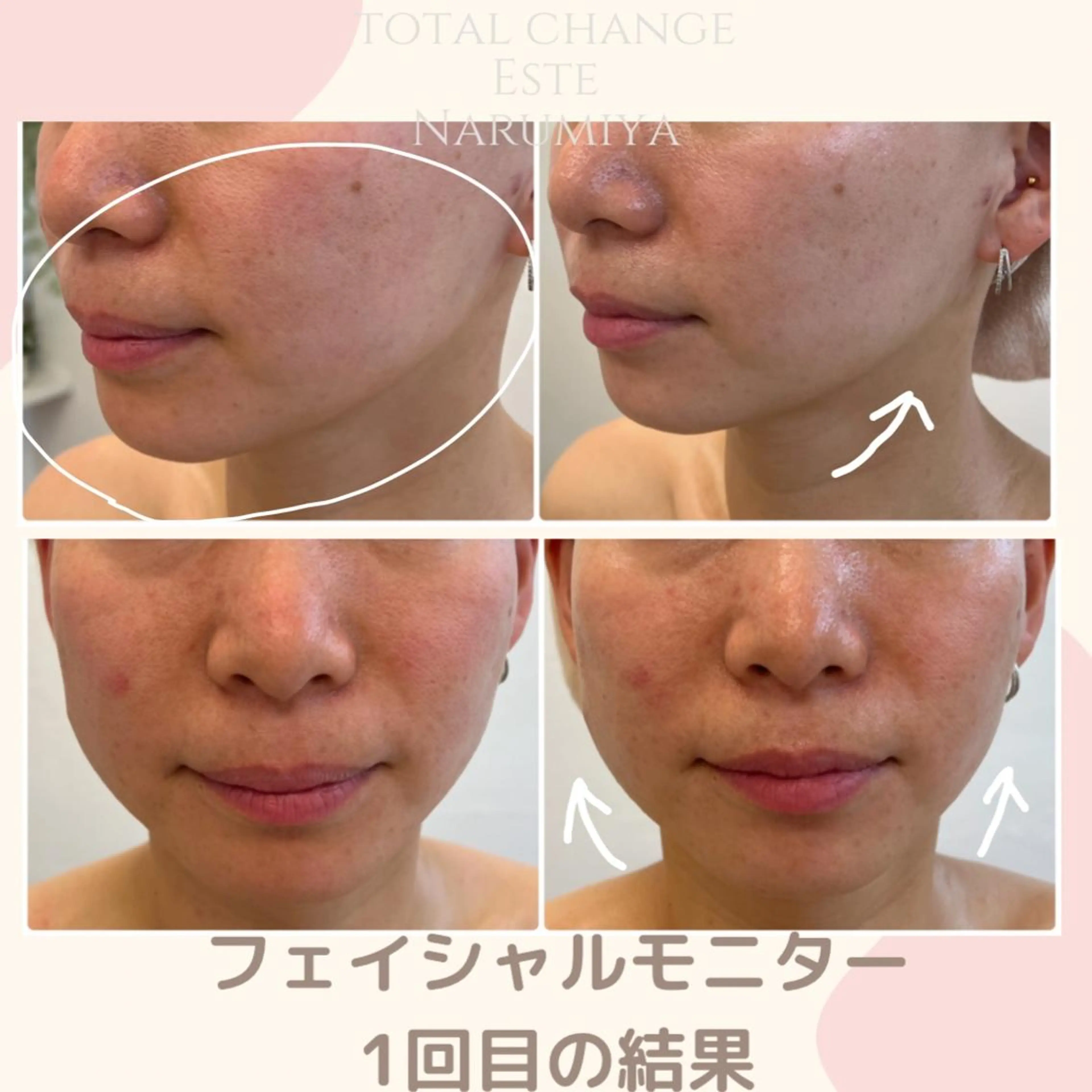 エステ 辻 佐耶のエステ・リラクイメージ