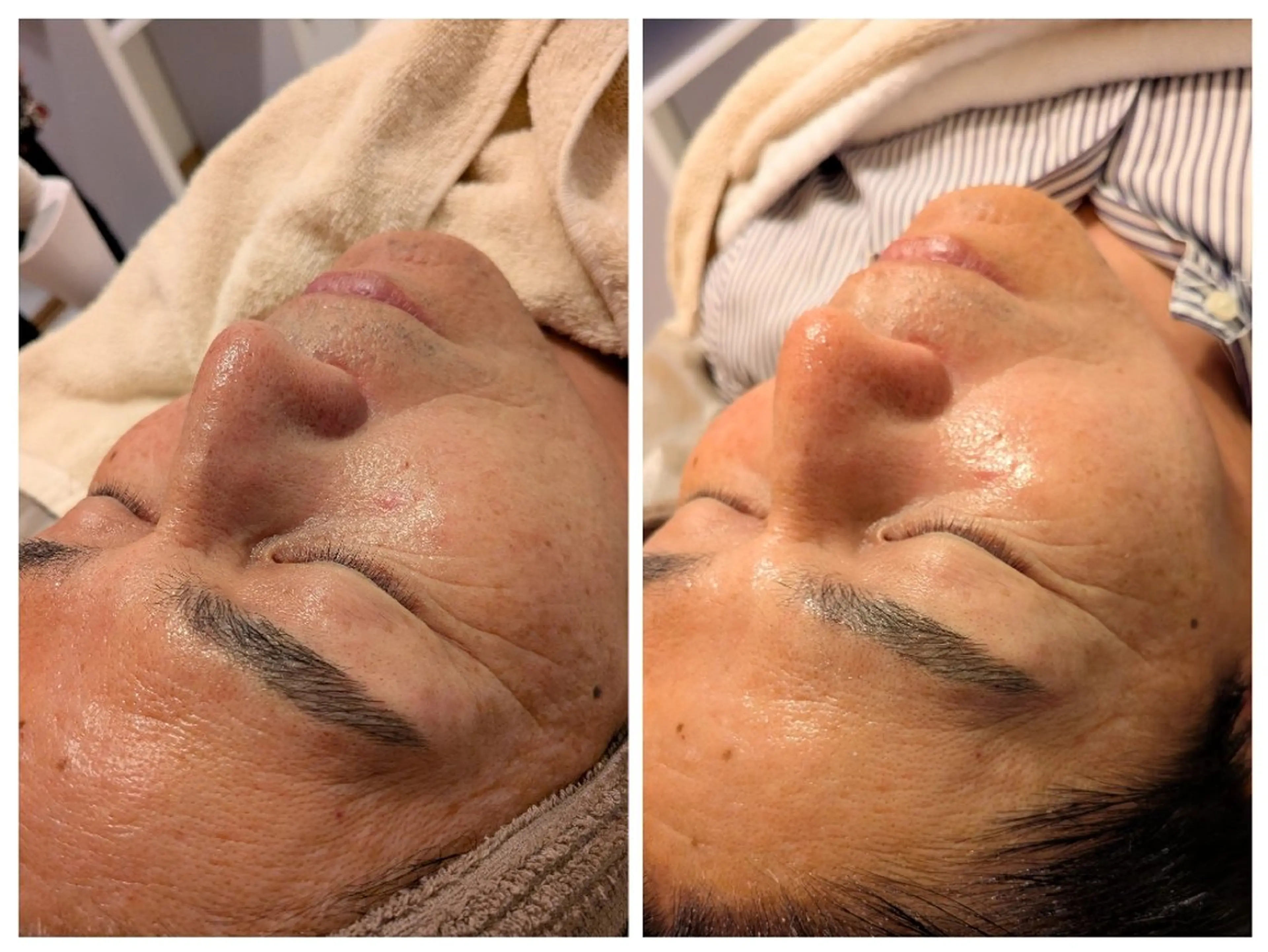 話題! 【ツヤUP】最新美容液導入120分の写真