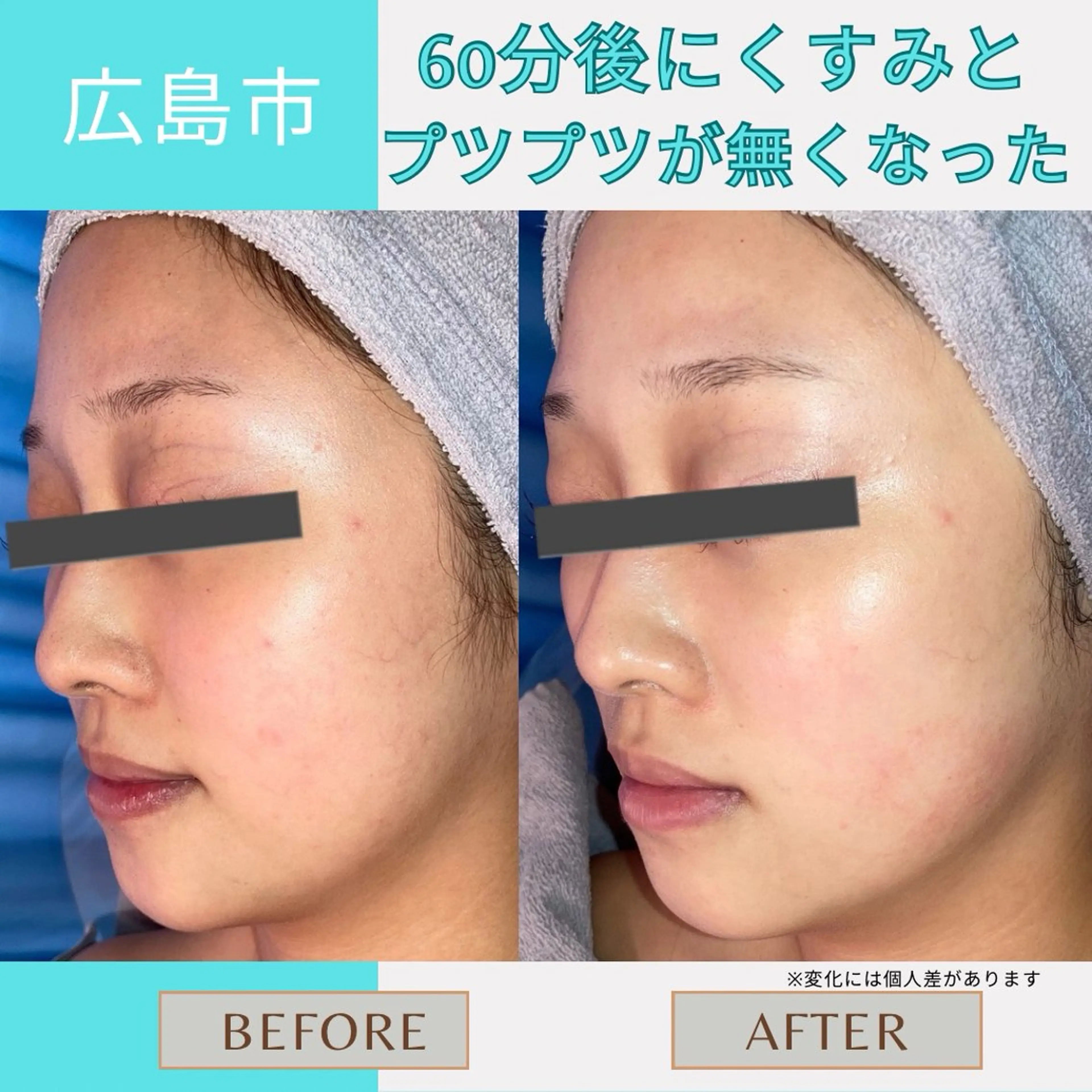 フェイシャルエステLe・Ciel所属・Le・Ciel フェイシャル&ボディのエステ・リラクイメージ