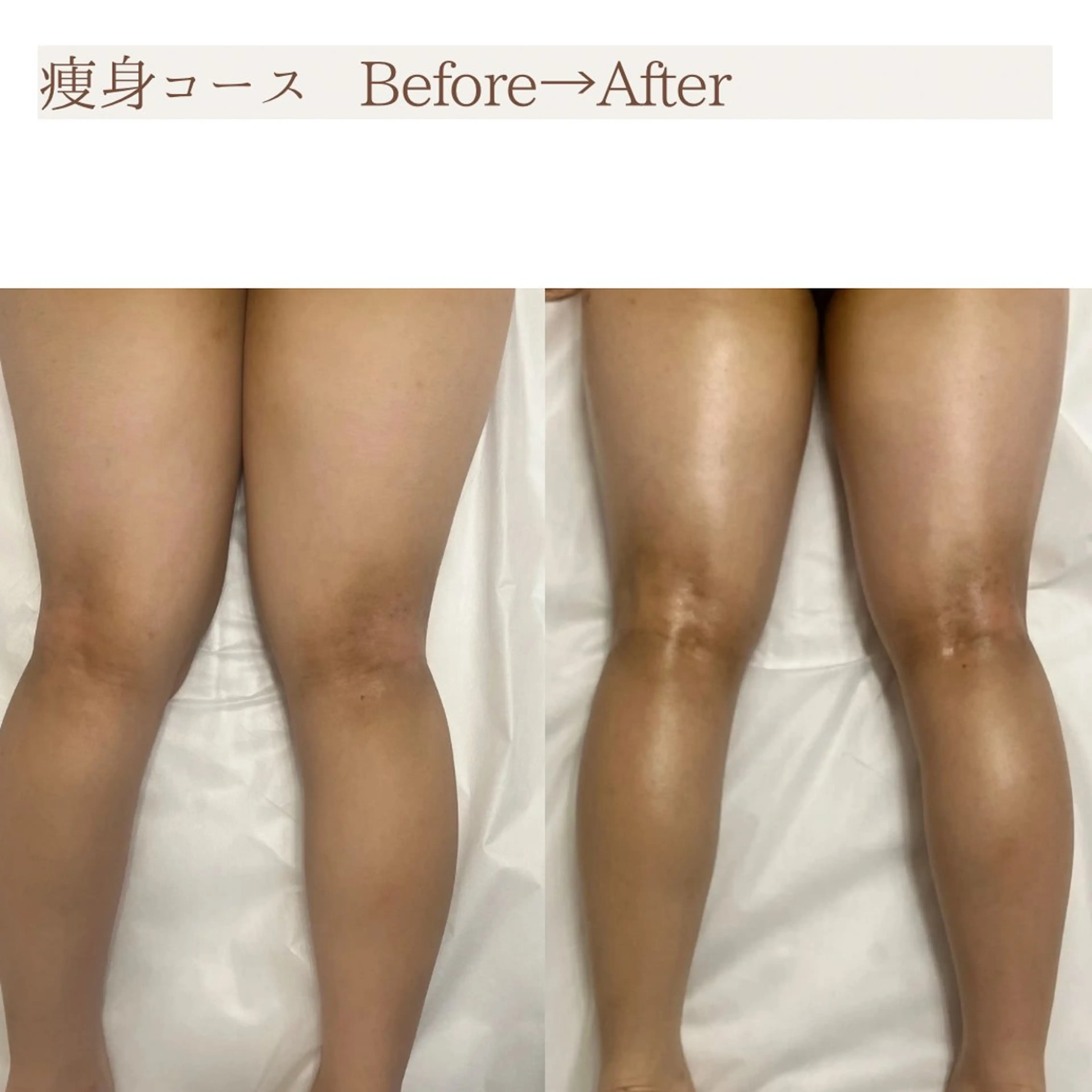 Total Beauty salon Bloom所属・肌育WISHpro 専門サロンBloomのエステ・リラクイメージ