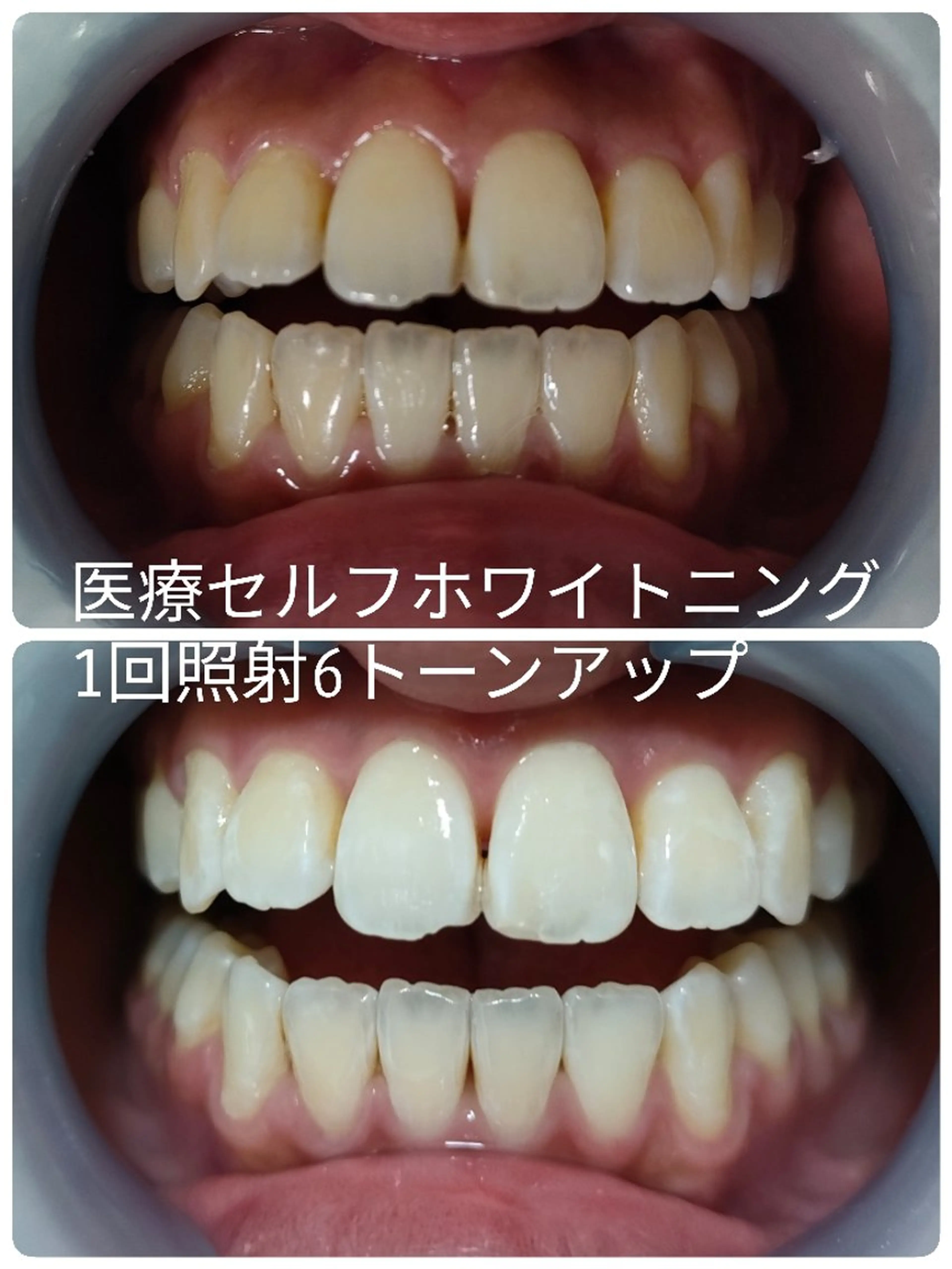 ほわいと あざぶのマツエク・マツパデザイン