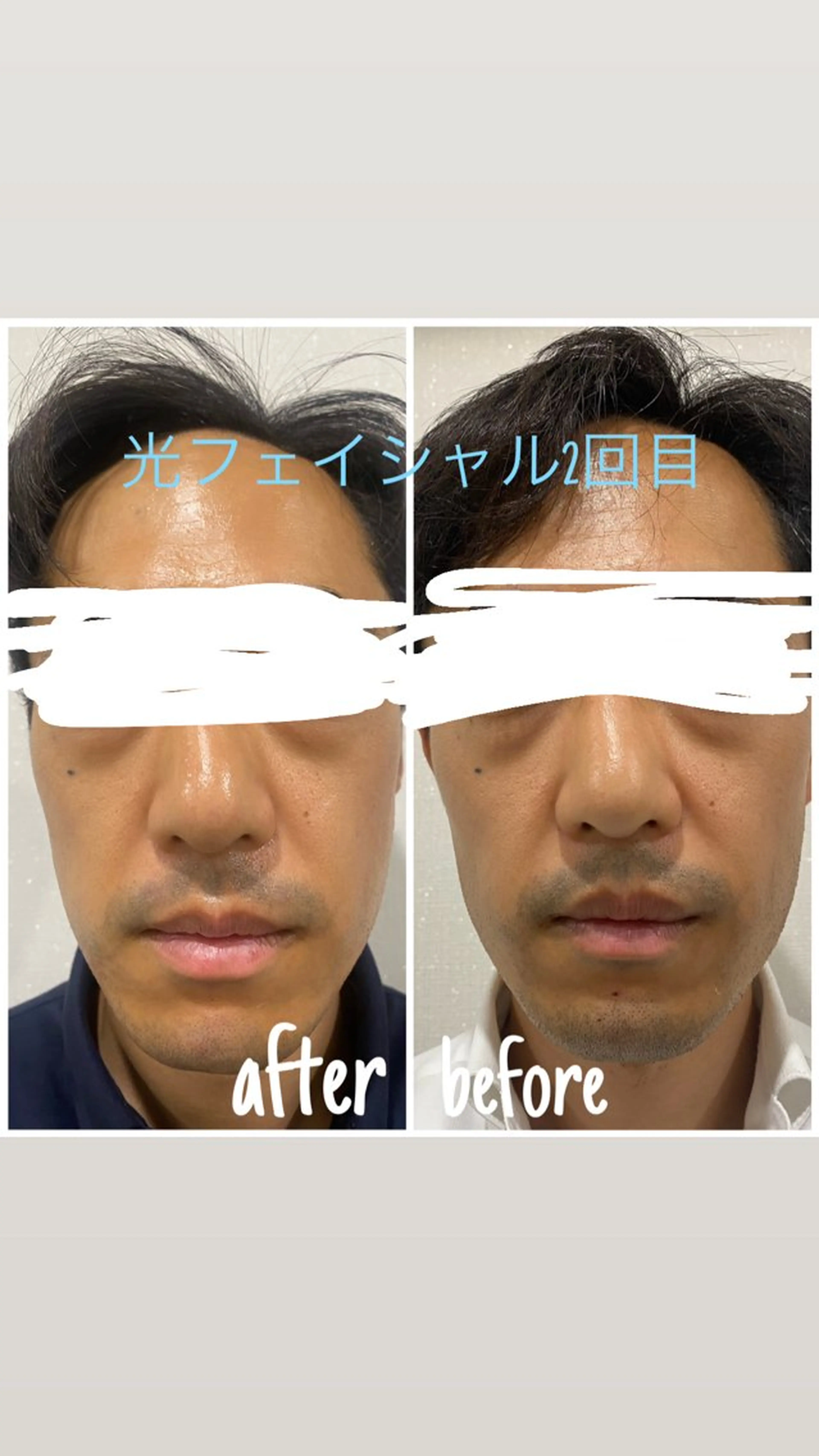 エステ 毛穴洗浄・痩身・脱毛 /アルカンジュのエステ・リラクイメージ