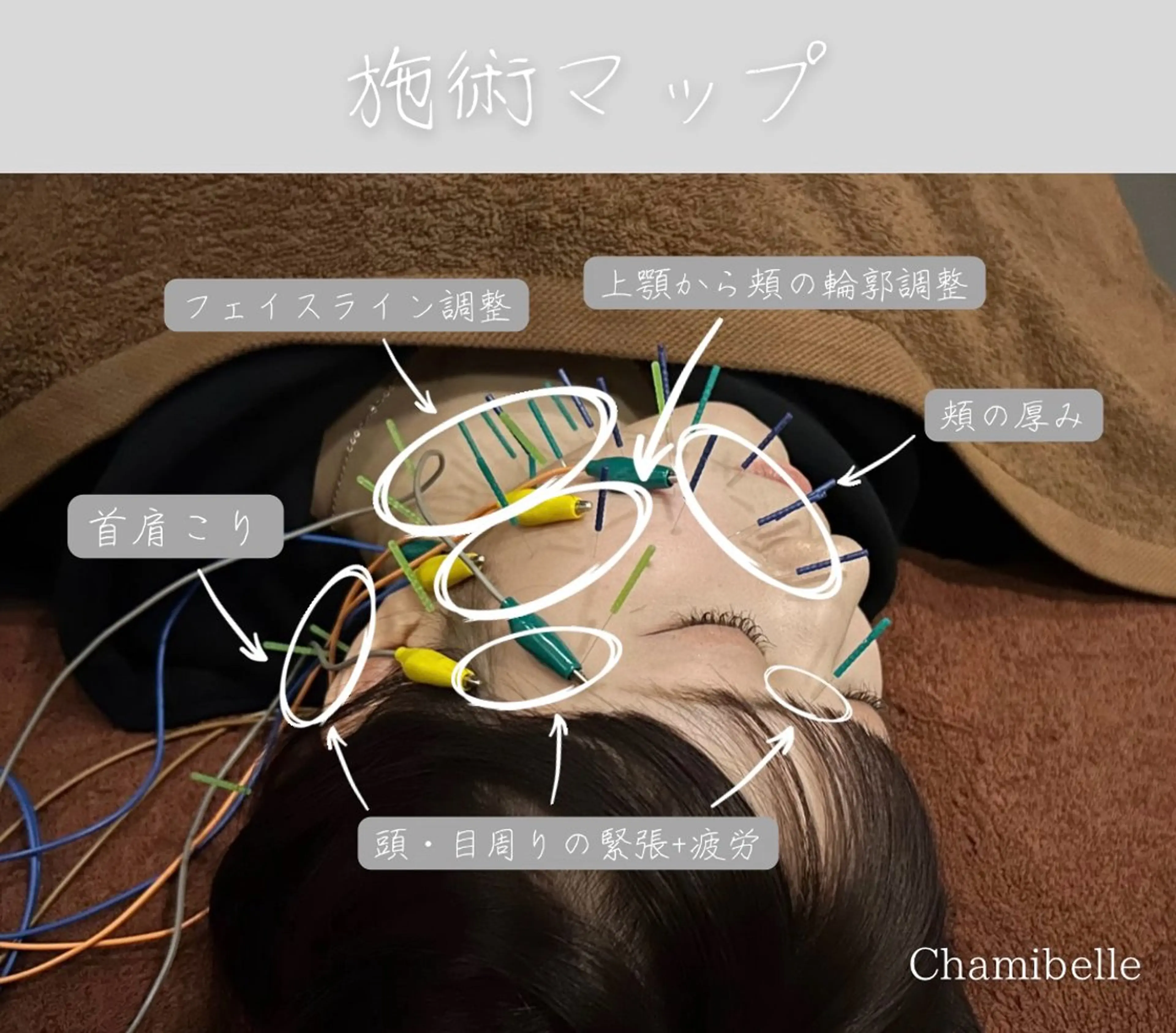 エステ リラク 美容鍼灸サロン Chamibelleのエステ・リラクイメージ