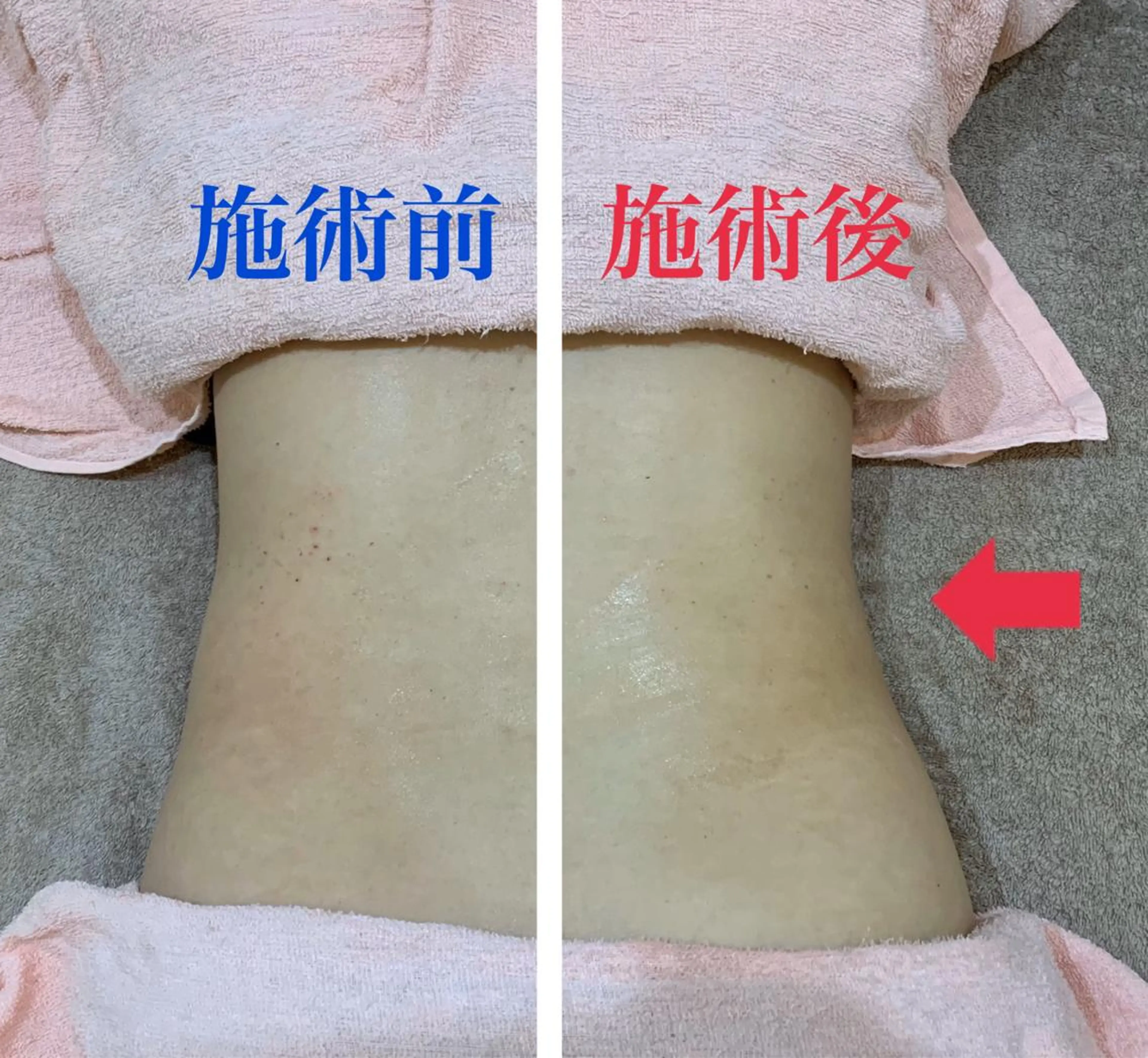 札幌ホワイトニング ラディアンス札幌駅店のその他イメージ