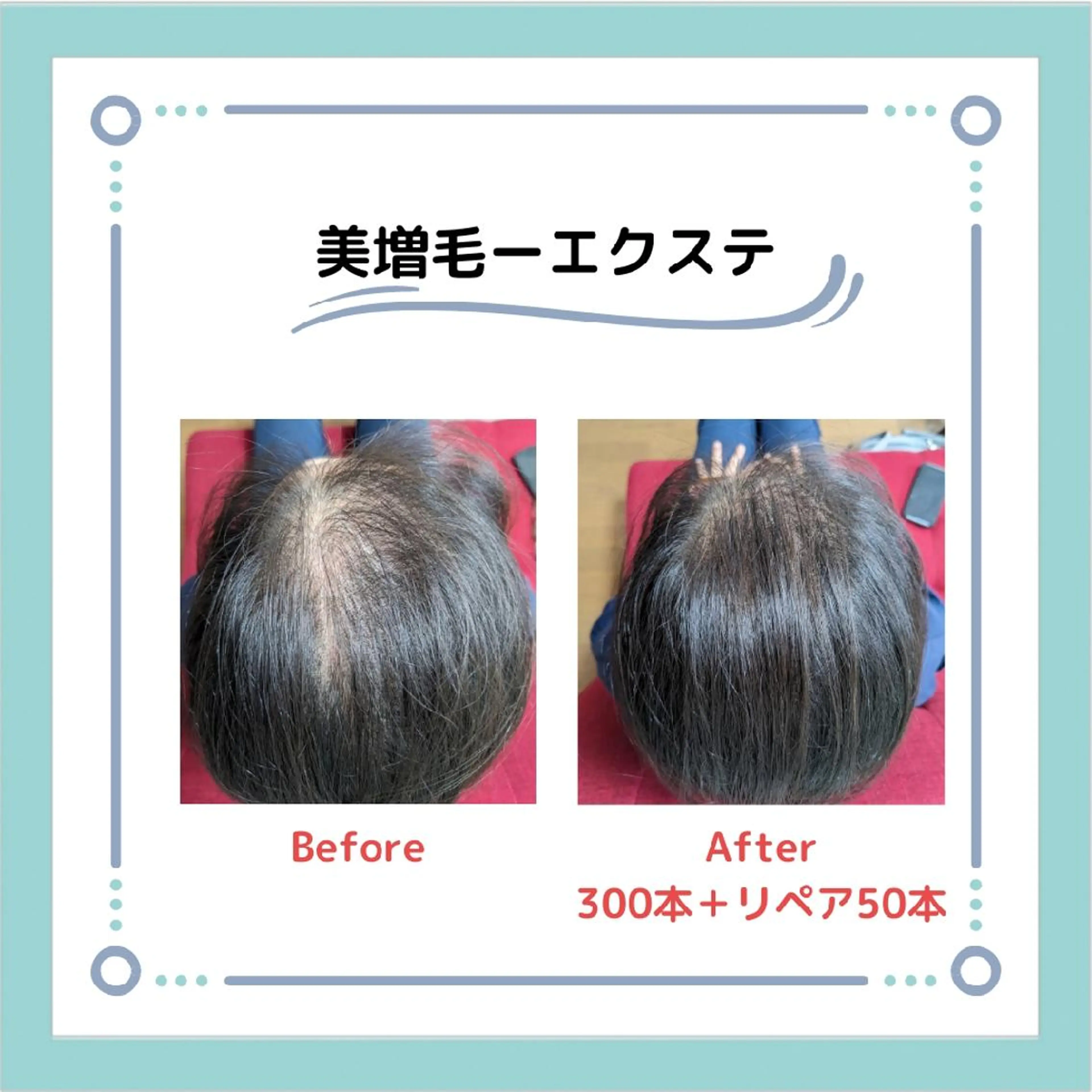 🌈増毛エクステ🌈薄い生え際、薄毛、白髪隠しのトップに🥰ファイバー毛を地毛一本に2〜4本結びつけます💕お試200本の写真