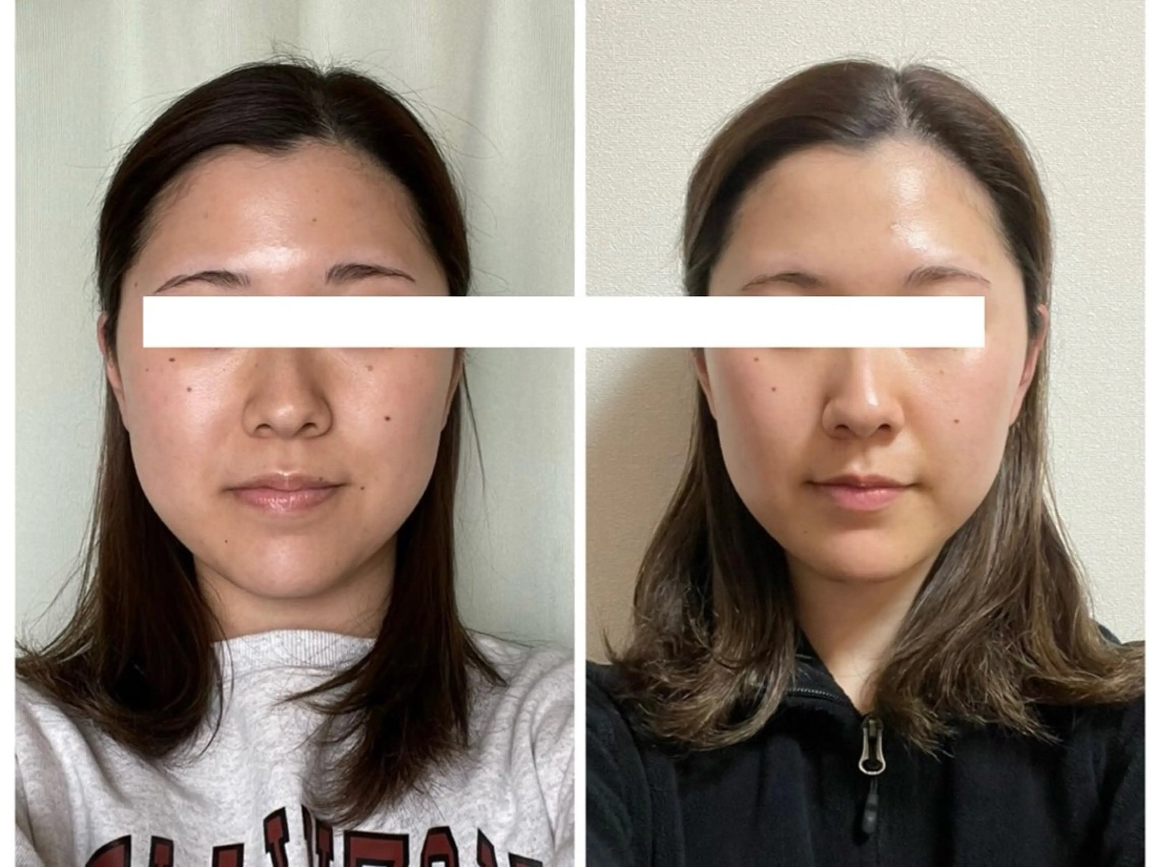 エステ 丸顔さんの救世主 高田 くみのエステ・リラクイメージ