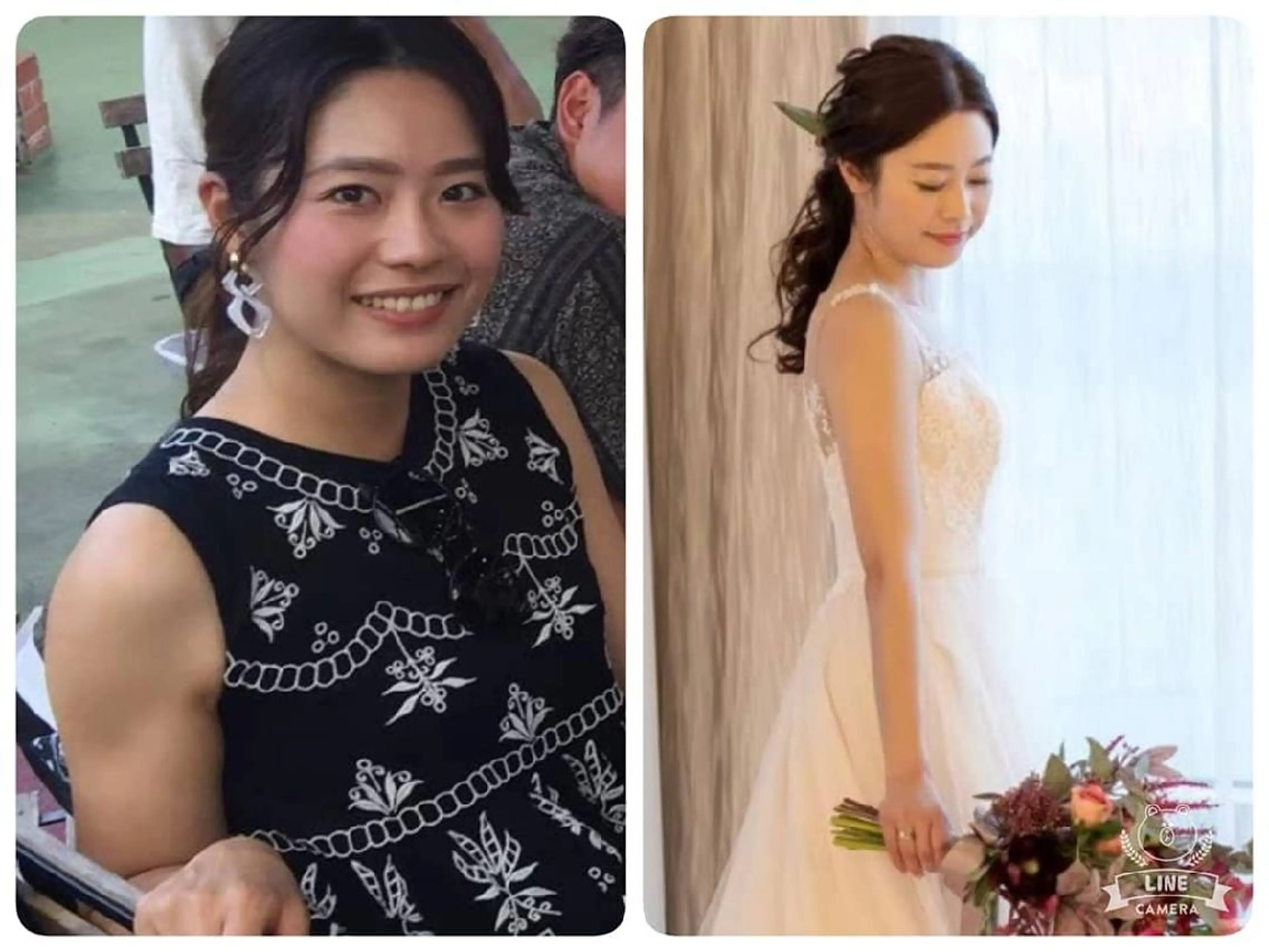 《初回限定》一番人気！深温高周波と強力超音波のパーソナルトリートメントの最強コース‼の写真