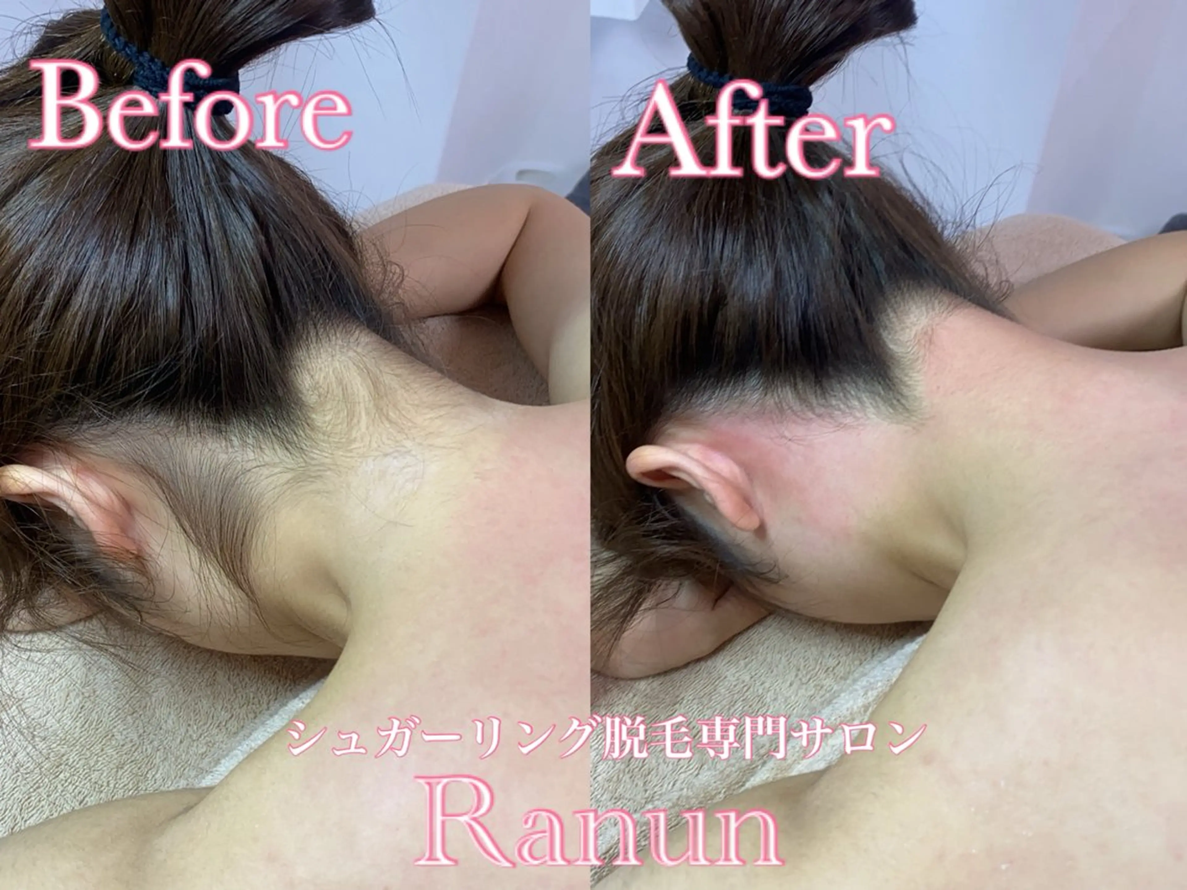 マツエク・マツパ 脱毛 シュガーリング脱毛 専門店Ranunのエステ・リラクイメージ