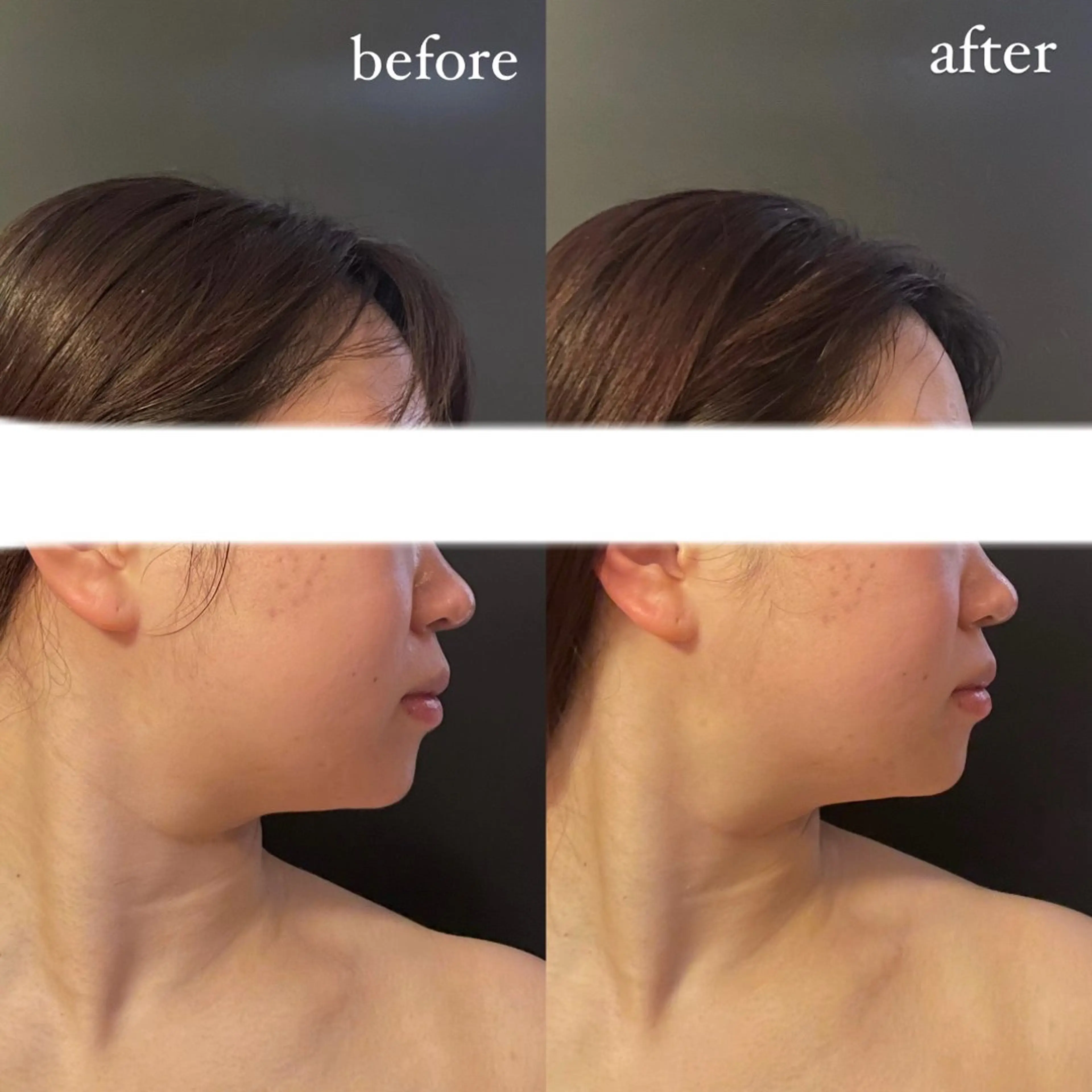 エステ リラク エステサロンino.colore'所属・小顔サロン ino.coloreのエステ・リラクイメージ