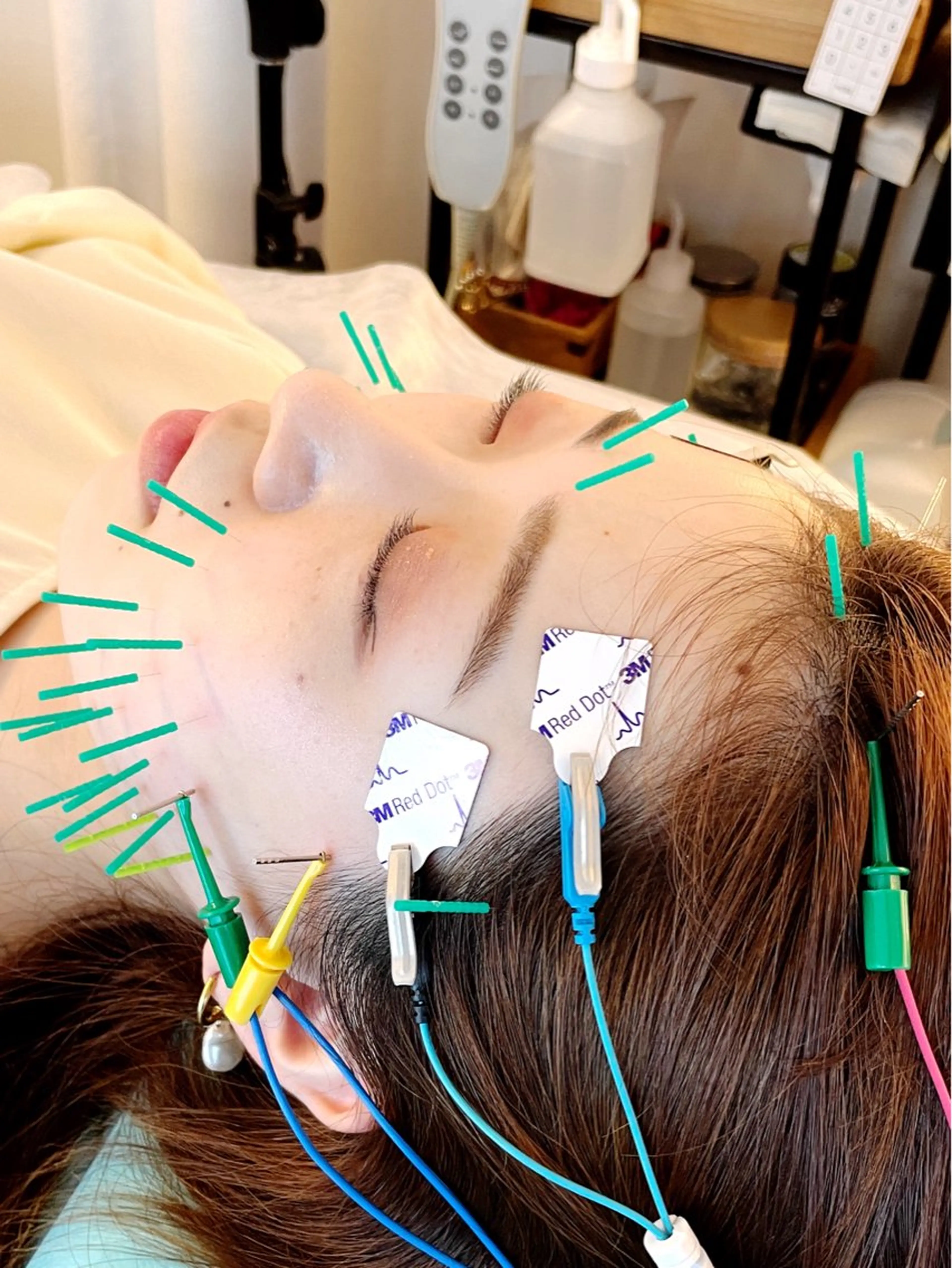 エステ リラク 小顔美容鍼専門サロン 渋谷YZのエステ・リラクイメージ