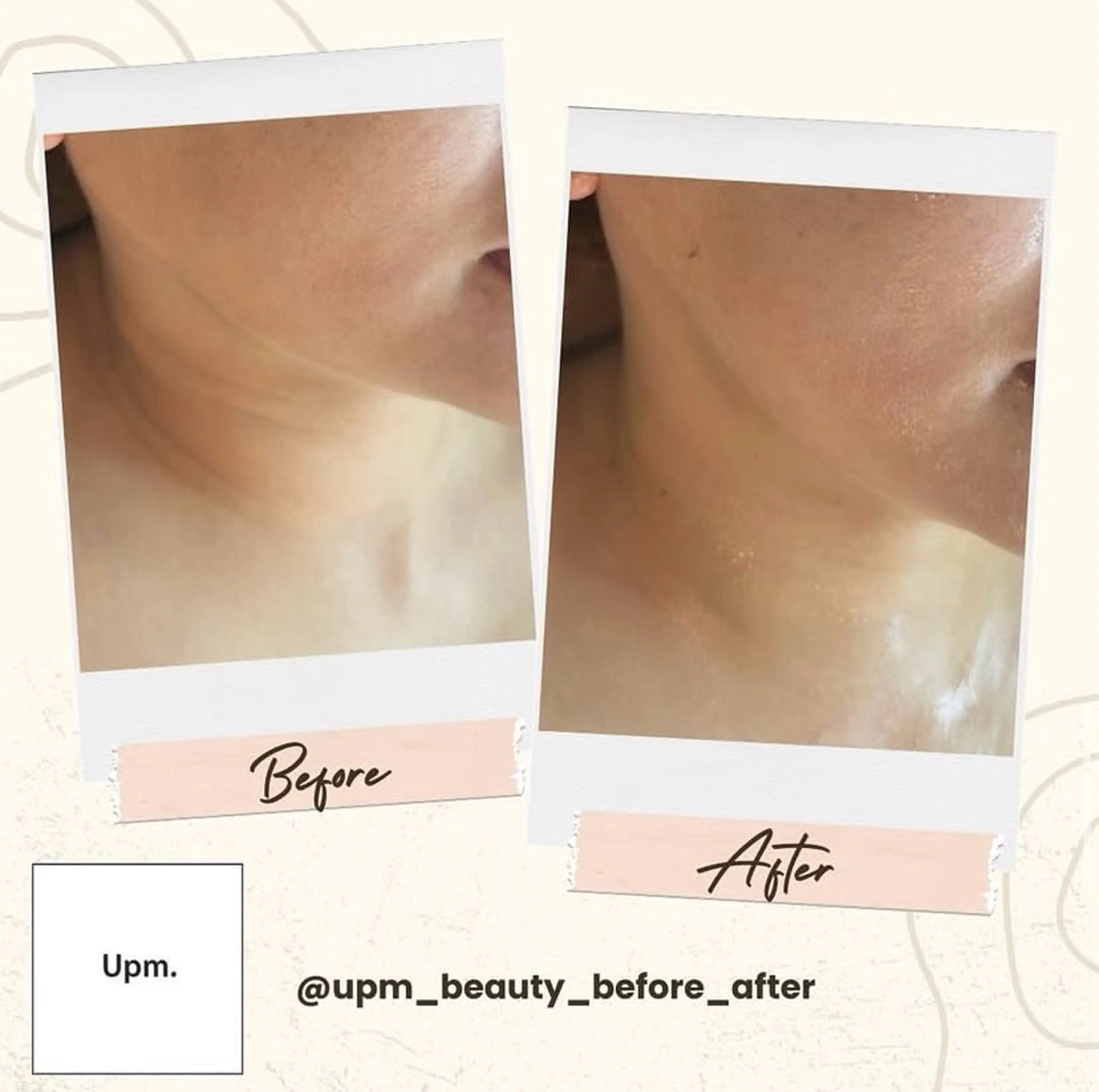 Upm.所属・成島 星哉のエステ・リラクイメージ