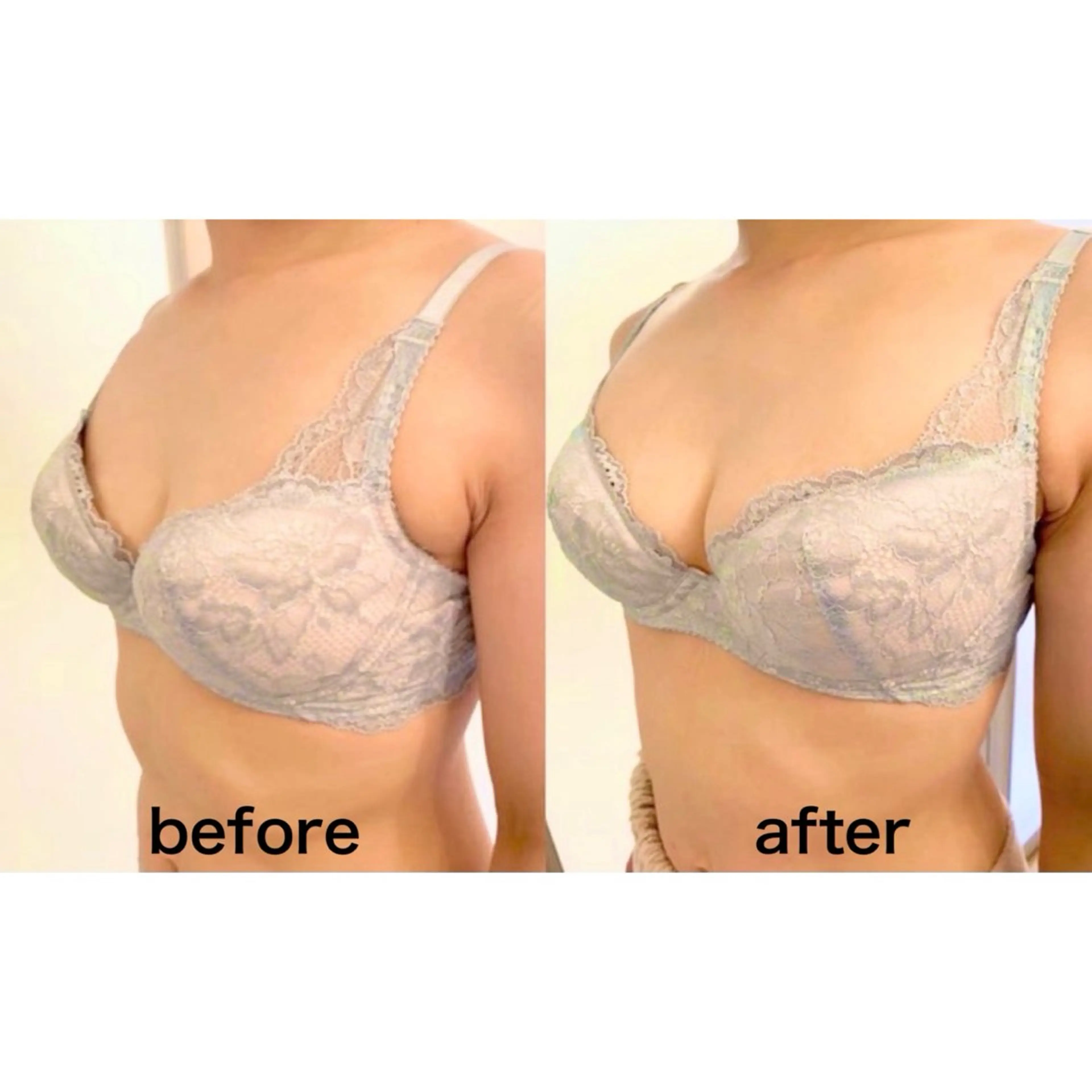 【ブライダル】ドレスをキレイに着こなす♡初回バスト体験の写真