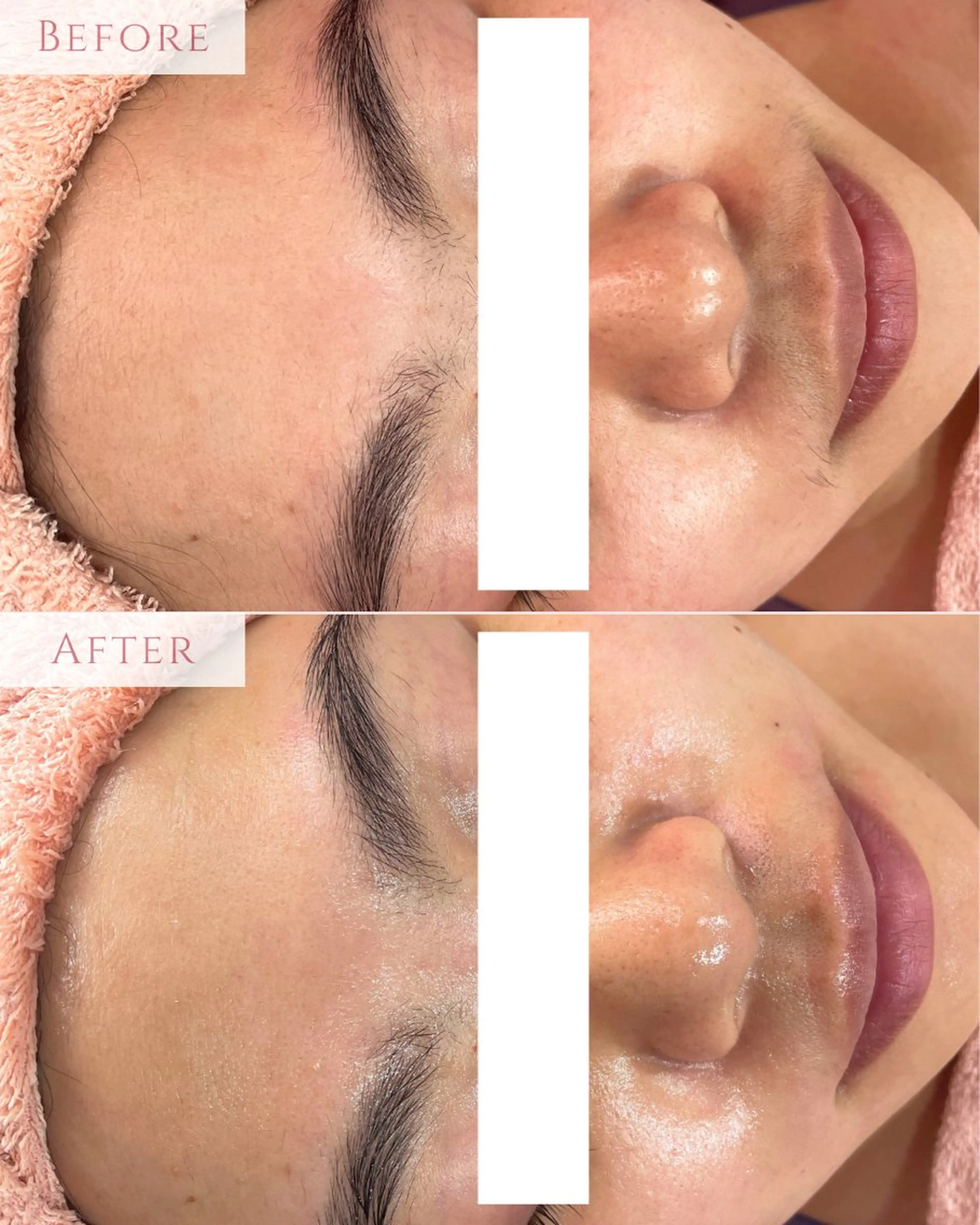 脱毛 肌質改善専門サロン Bellmi/心斎橋のエステ・リラクイメージ