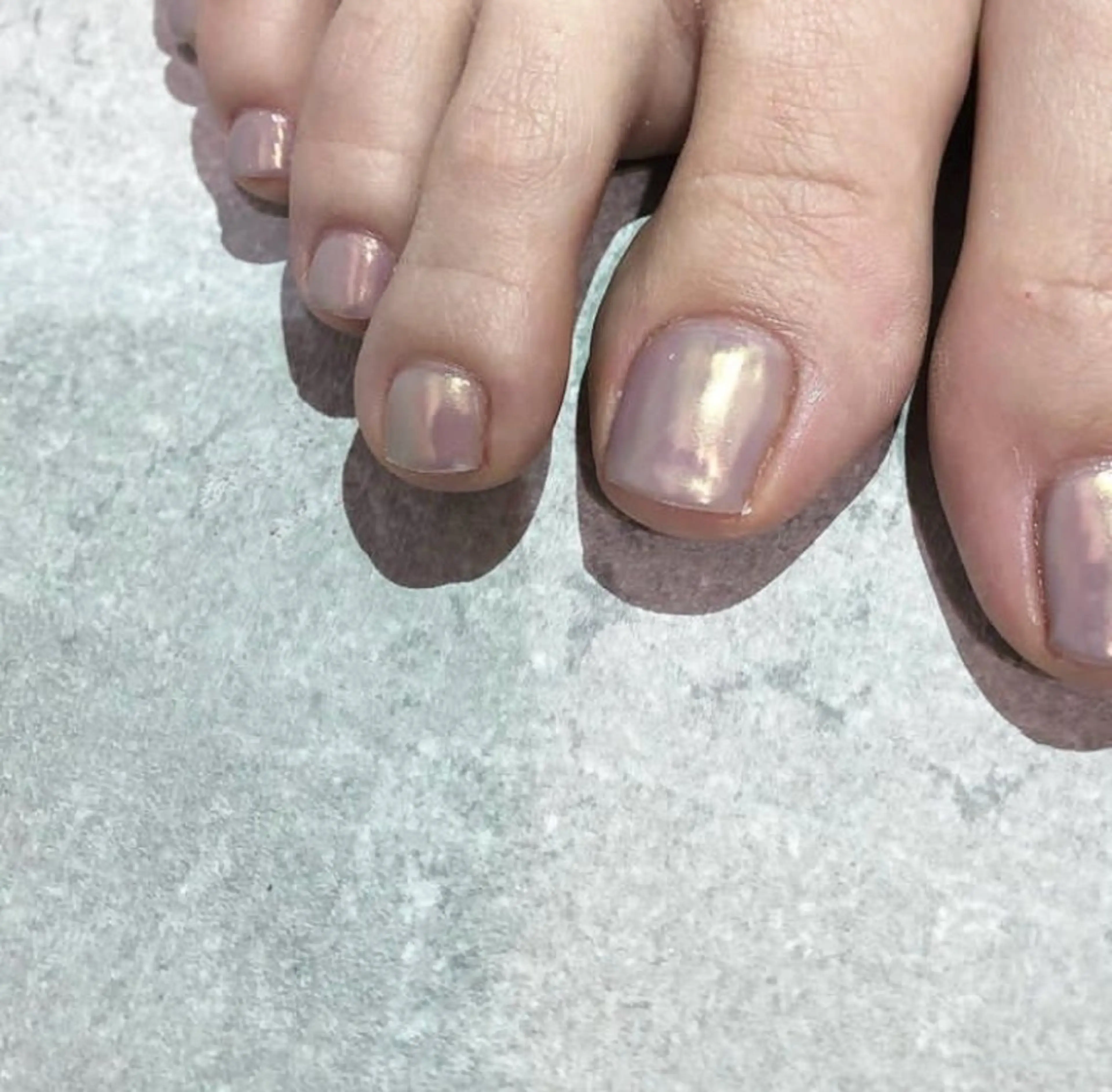 【フットネイル】　角質ケアの写真