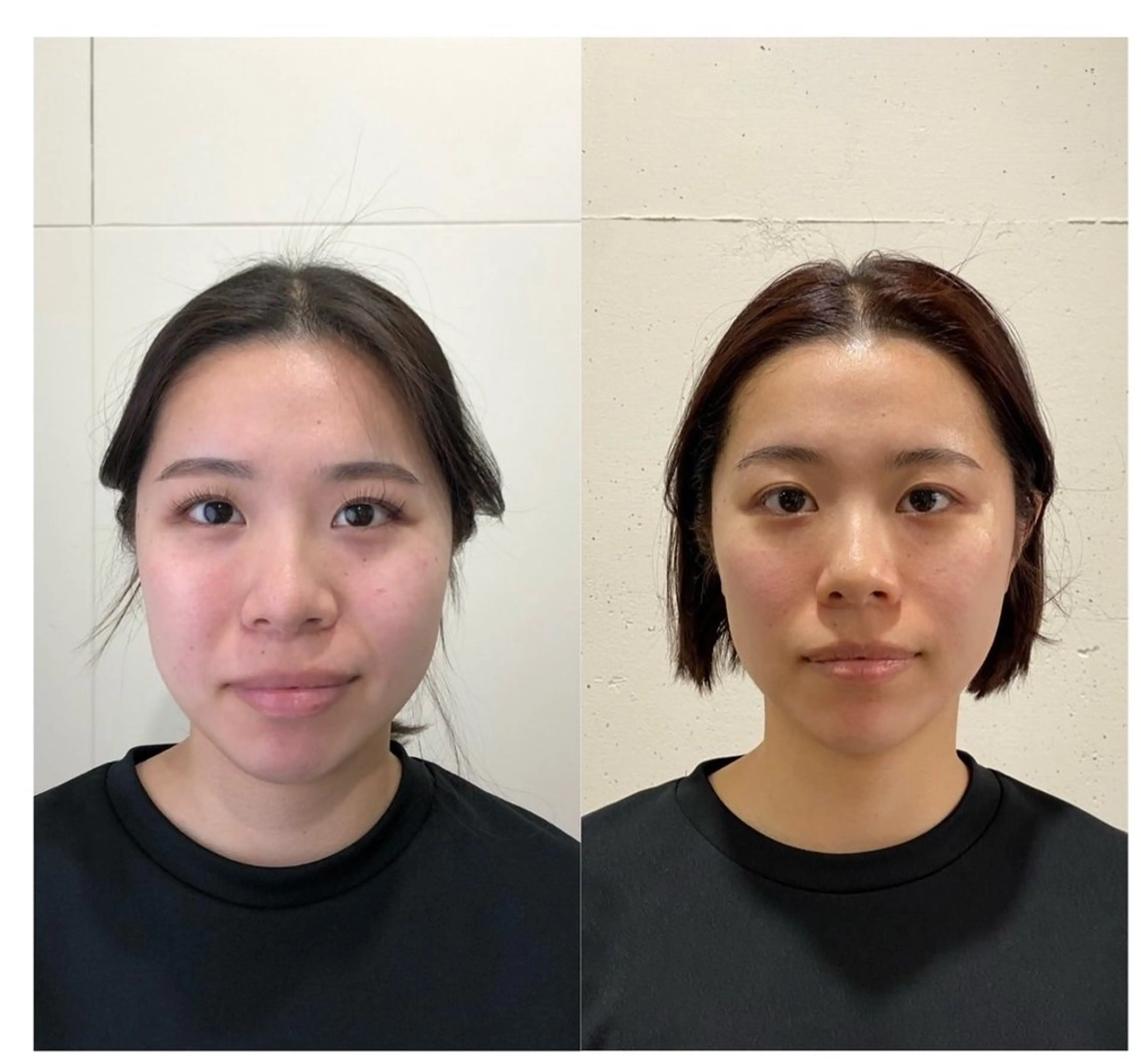 ☆【小顔矯正＋小顔マッサージ】通常￥7900の写真