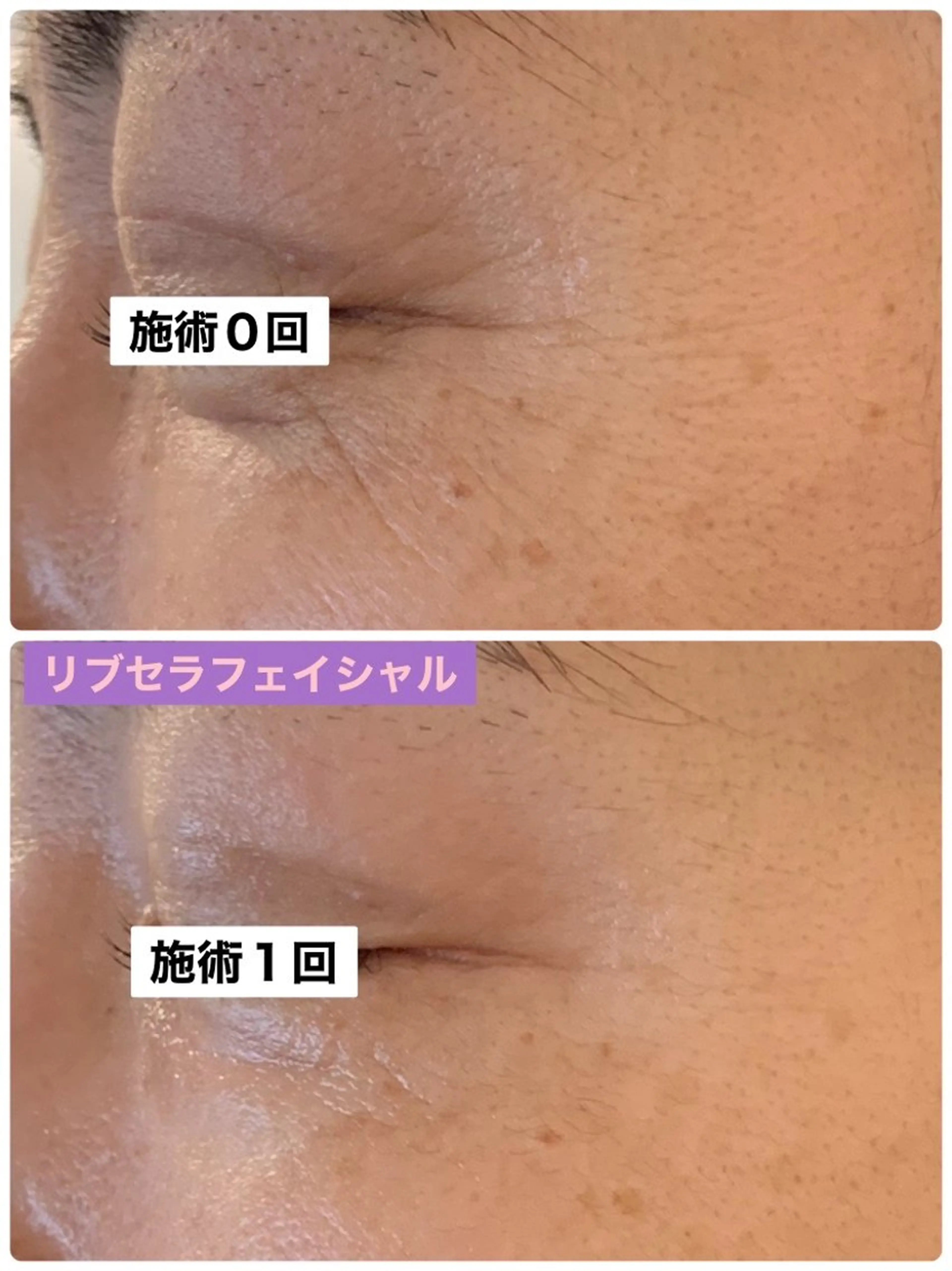 エステ Private Salon Prunelle所属・プライベートサロン プリュネルのエステ・リラクイメージ