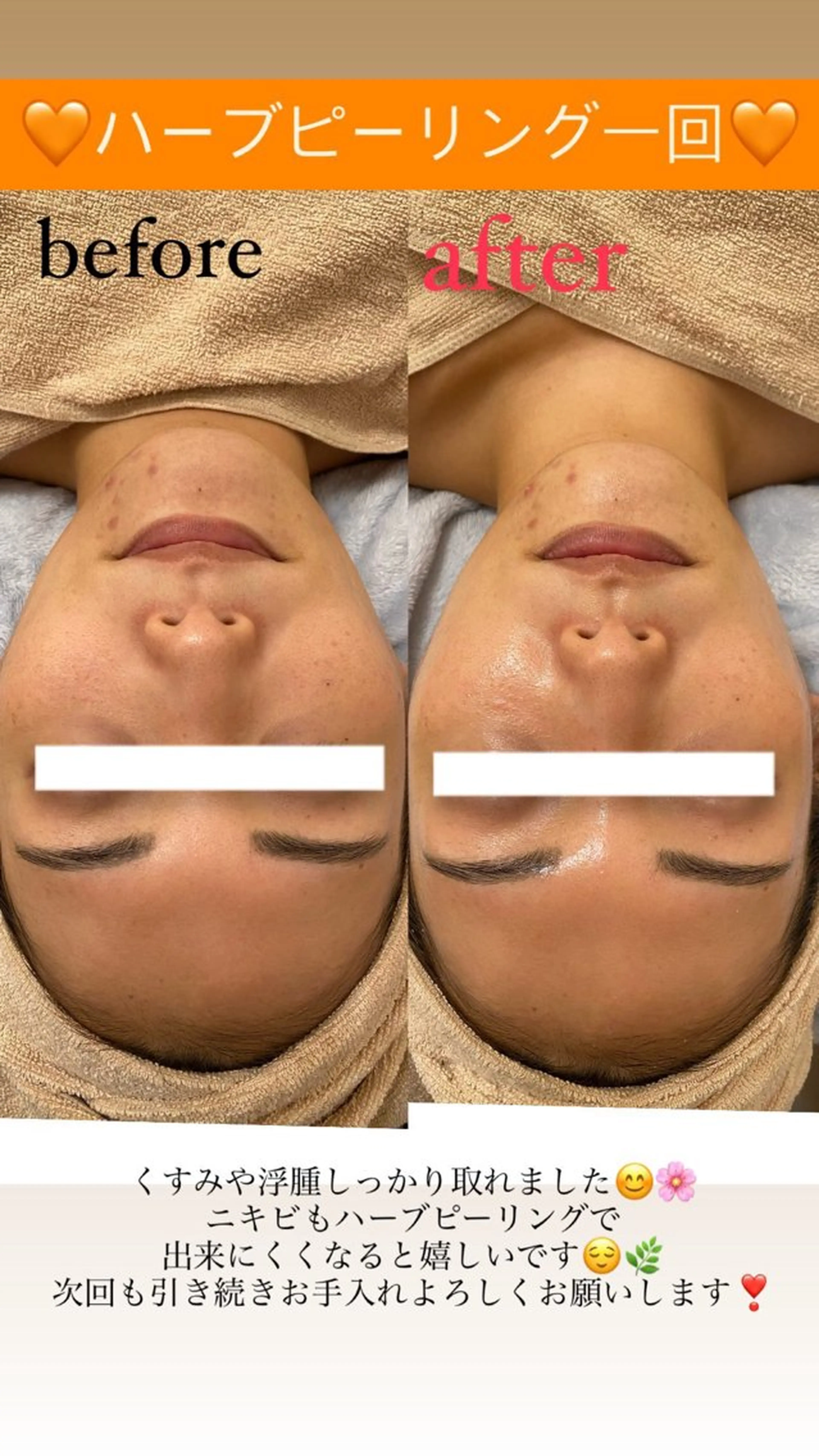 エステ Salon de Lino 御器所のエステ・リラクイメージ