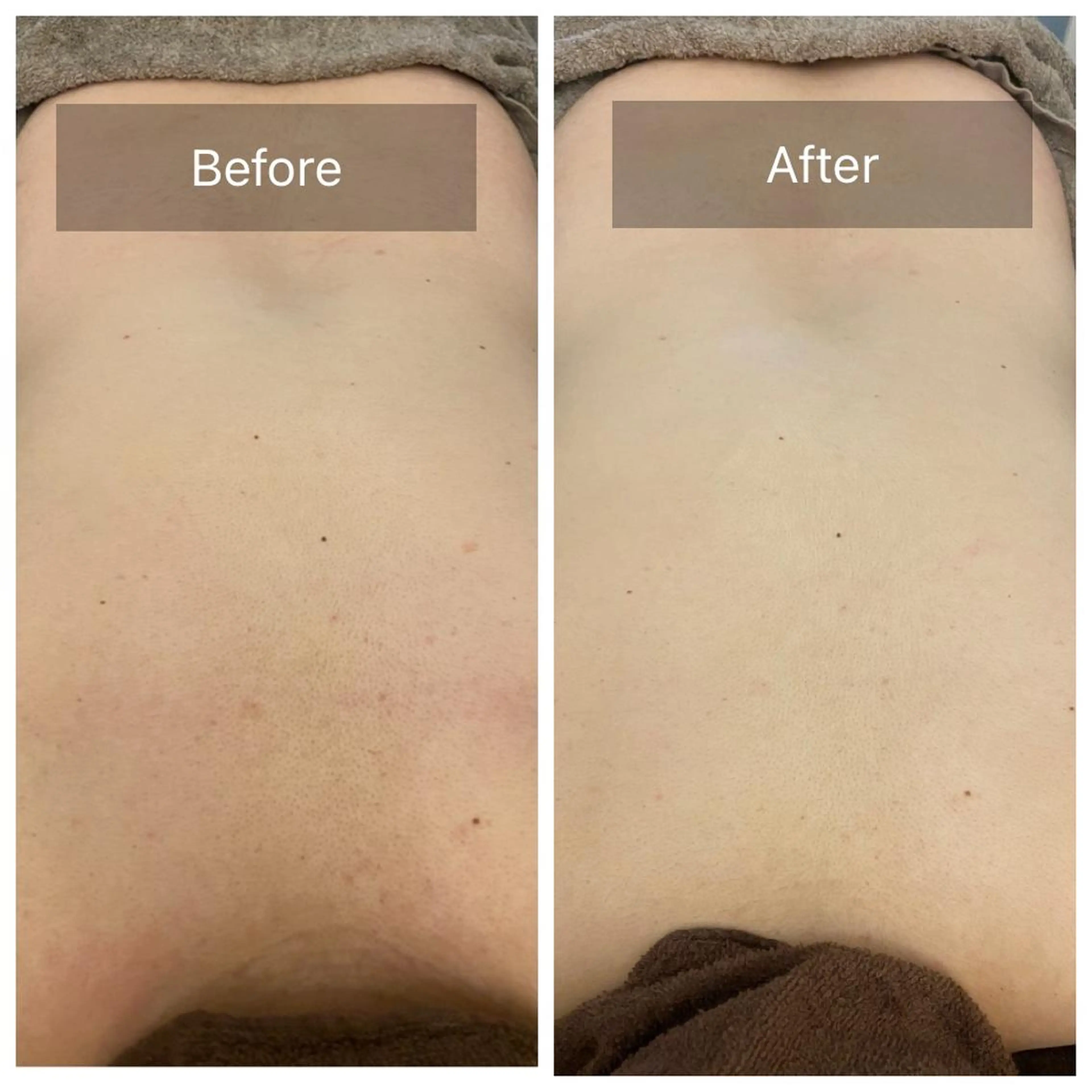 hm NATURESKINのエステ・リラクイメージ