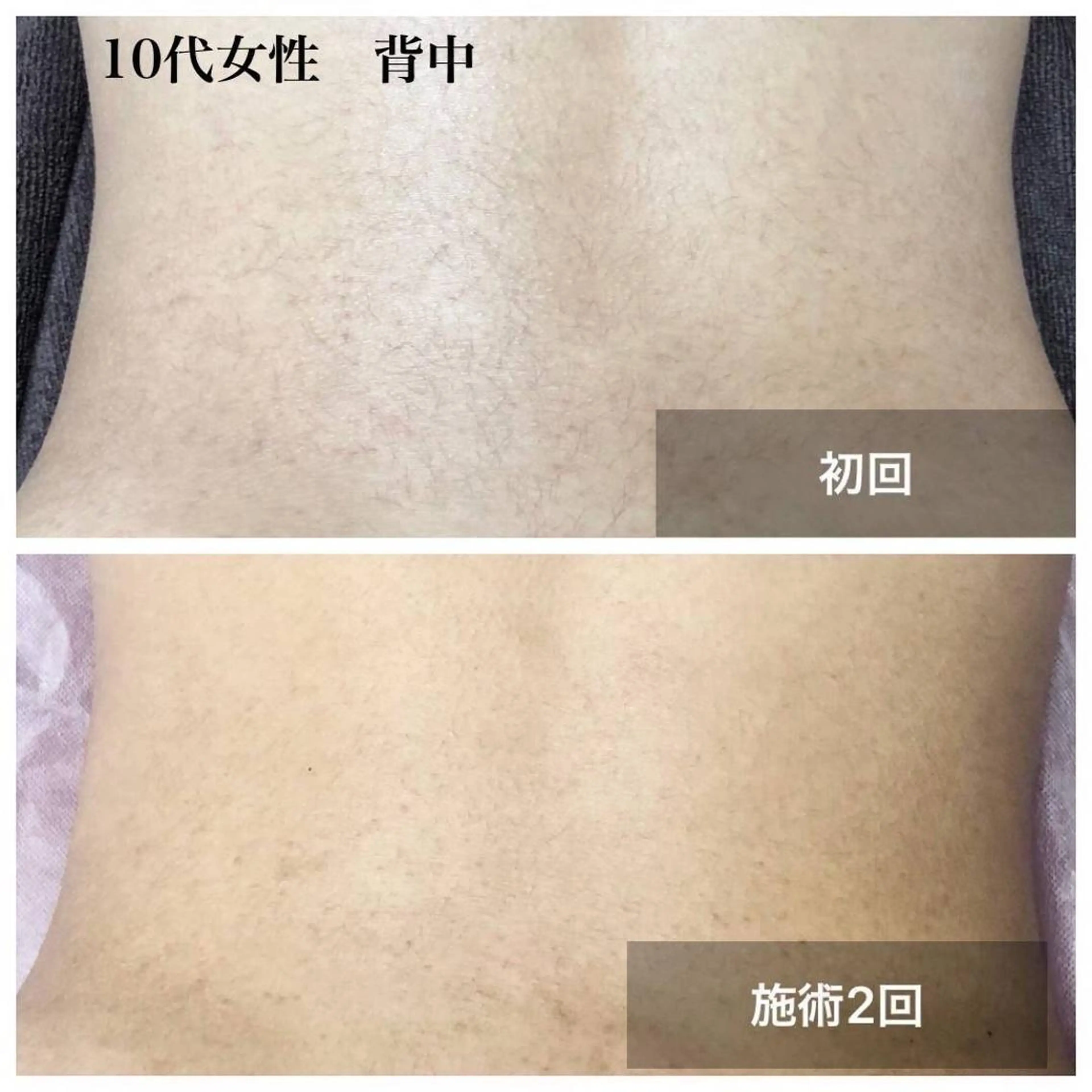 アルカンジュ~archange~所属・痩身/毛穴洗浄/脱毛 アルカンジュのエステ・リラクイメージ