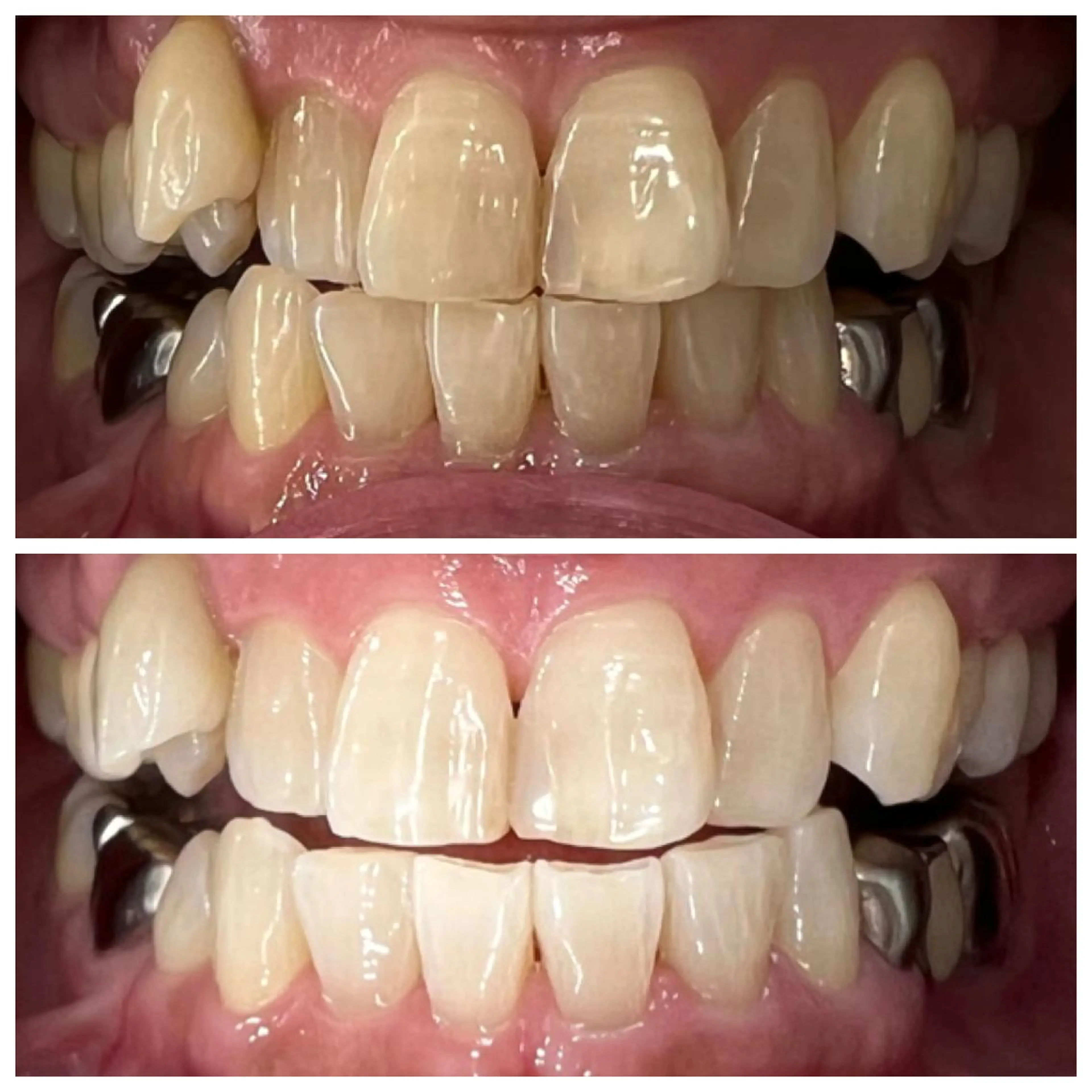 nailsalon   LE'A所属・ホワイトニング🦷 ネイル💅LEAのその他イメージ