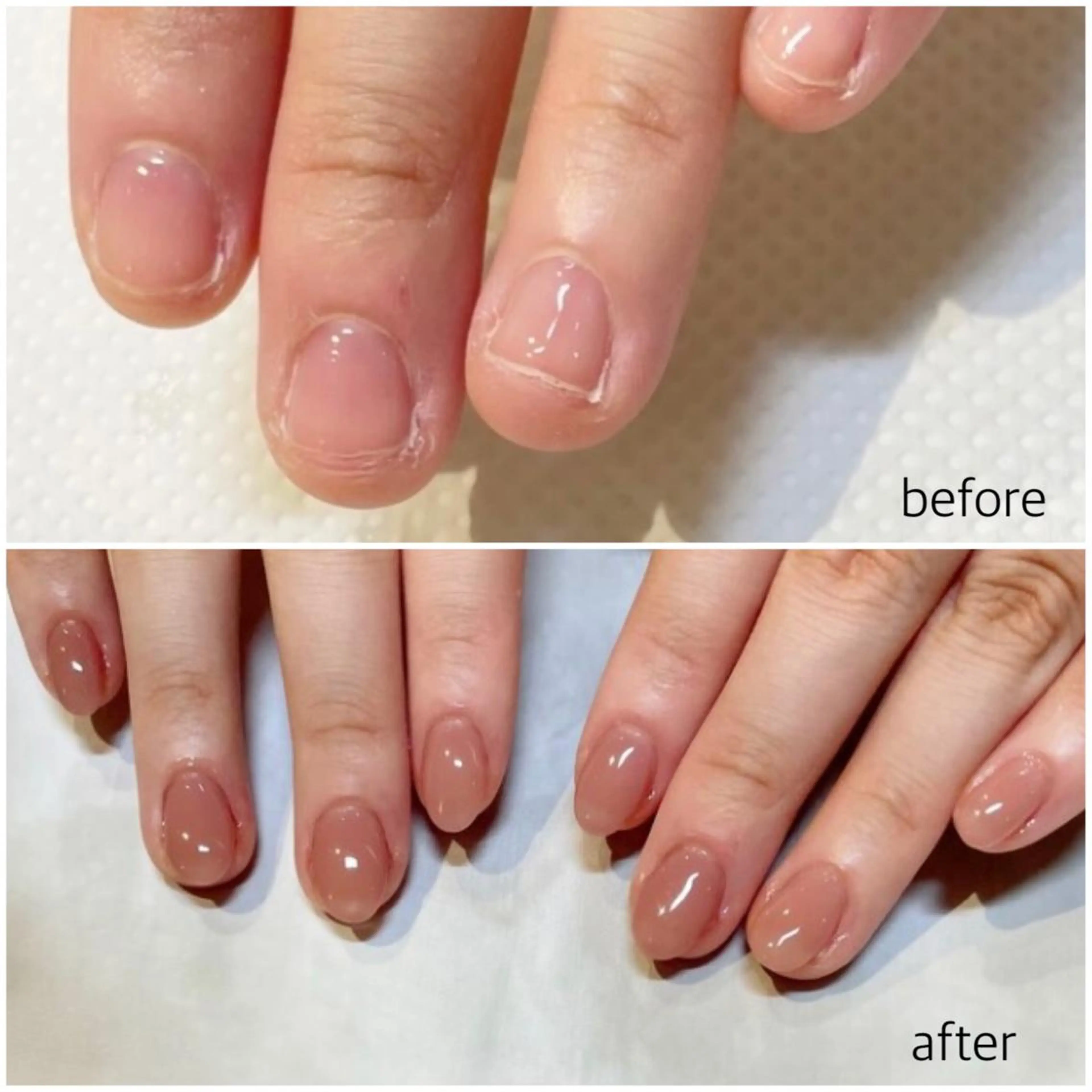 【深爪矯正+長さ出し】クリアジェルorナチュラルマット仕上げの写真