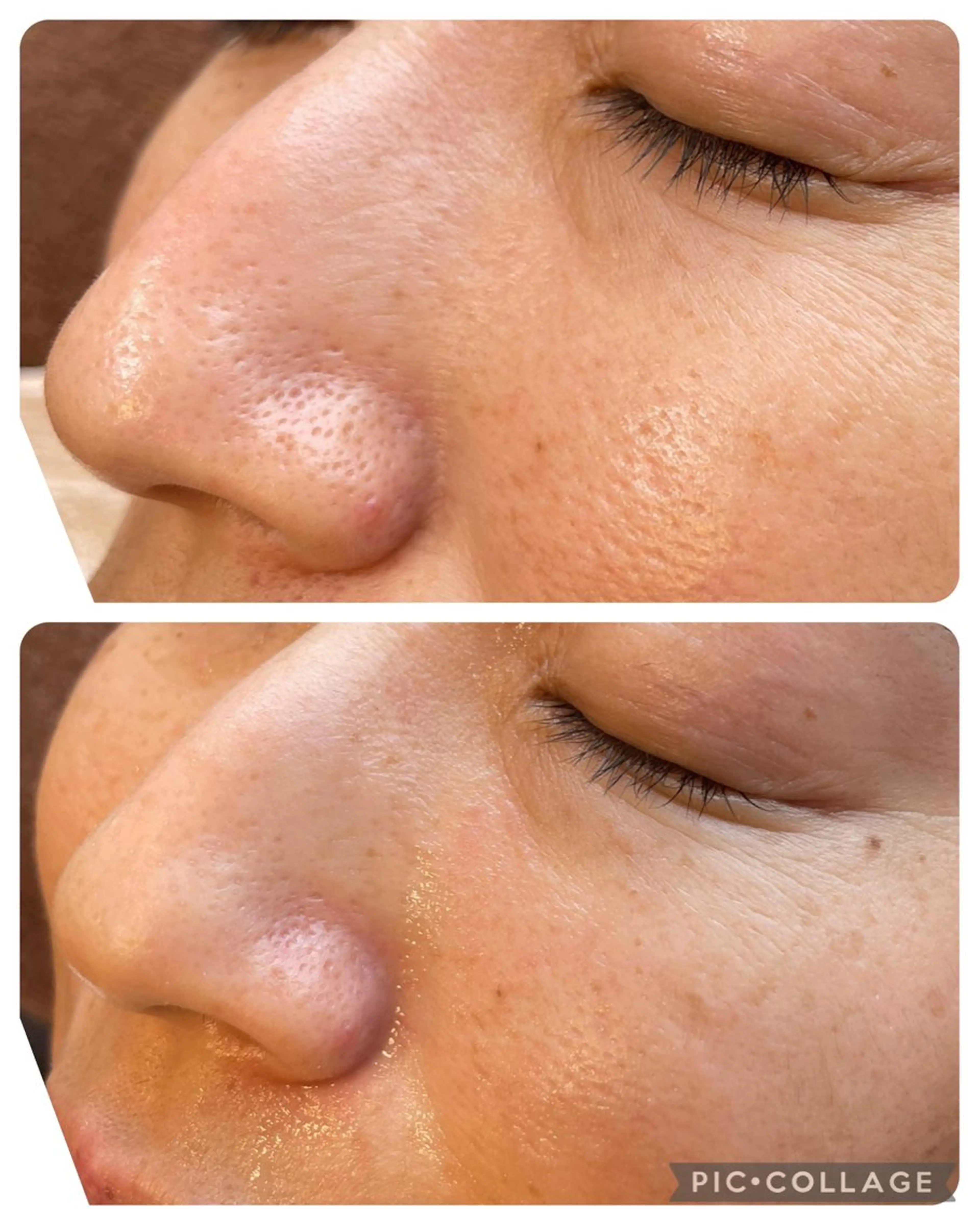 脱毛 emi ...の眉毛・アイブロウイメージ