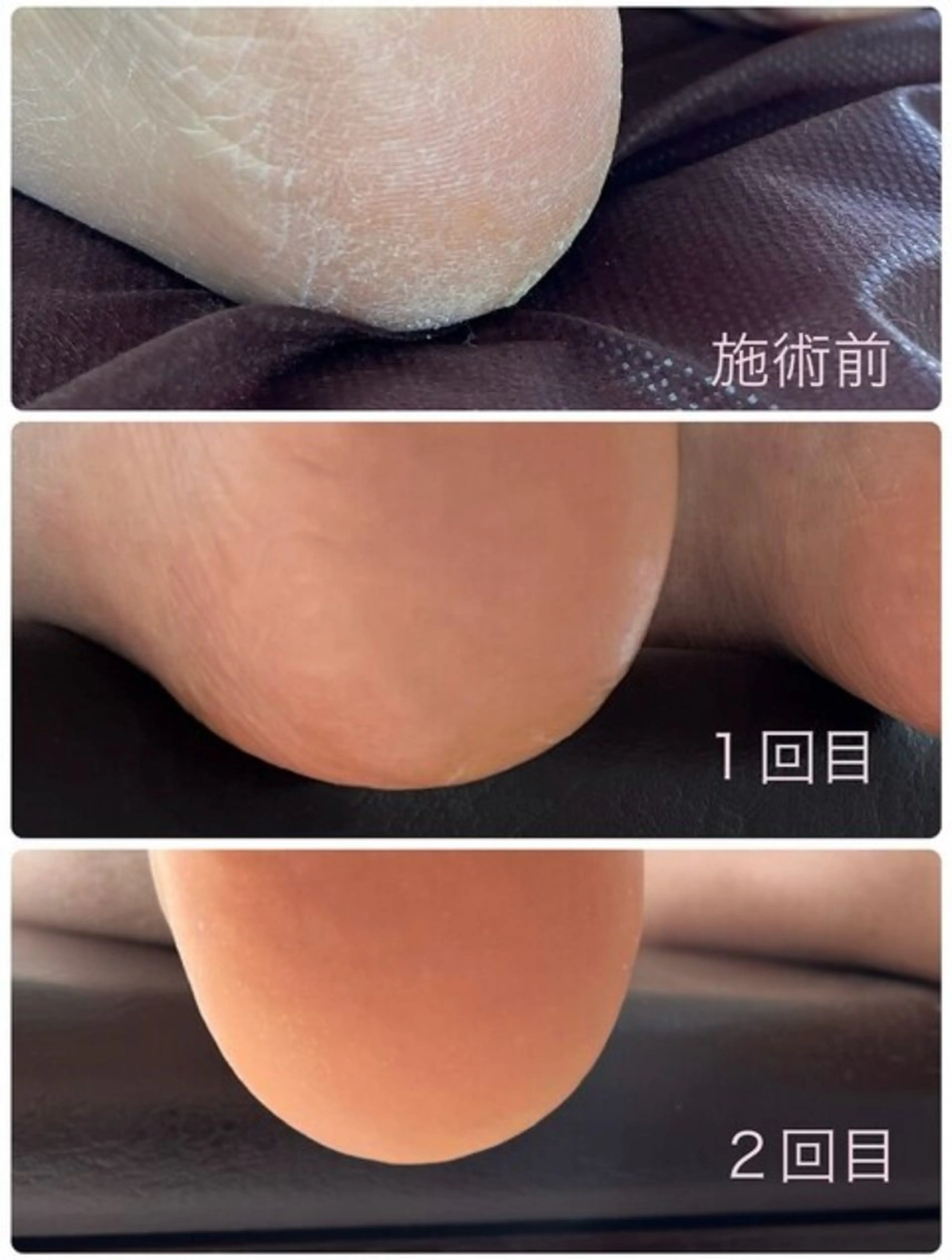 その他 mimo. suzukiのマツエク・マツパデザイン