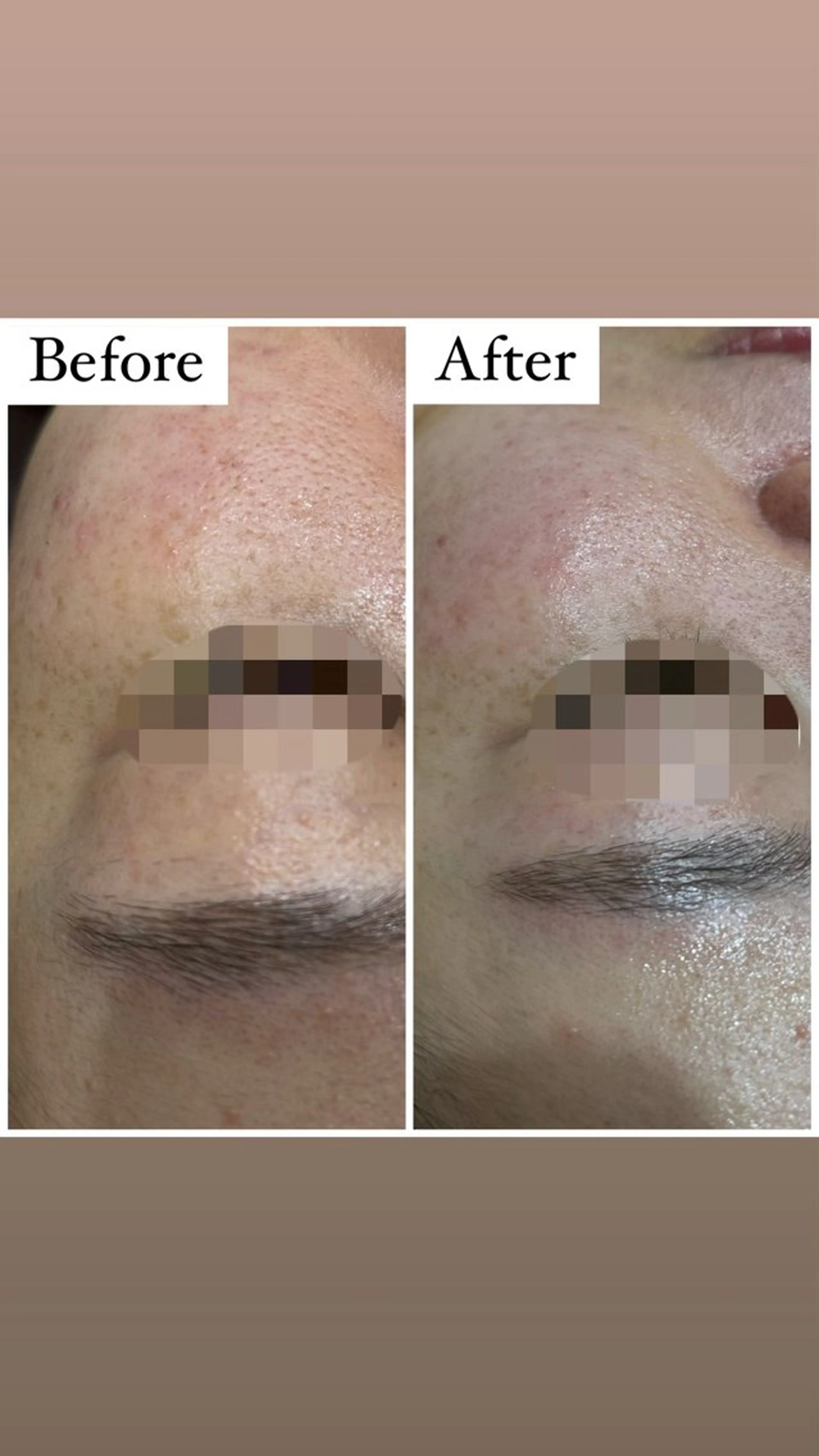 ハーブピーリング専門 muro.のエステ・リラクイメージ