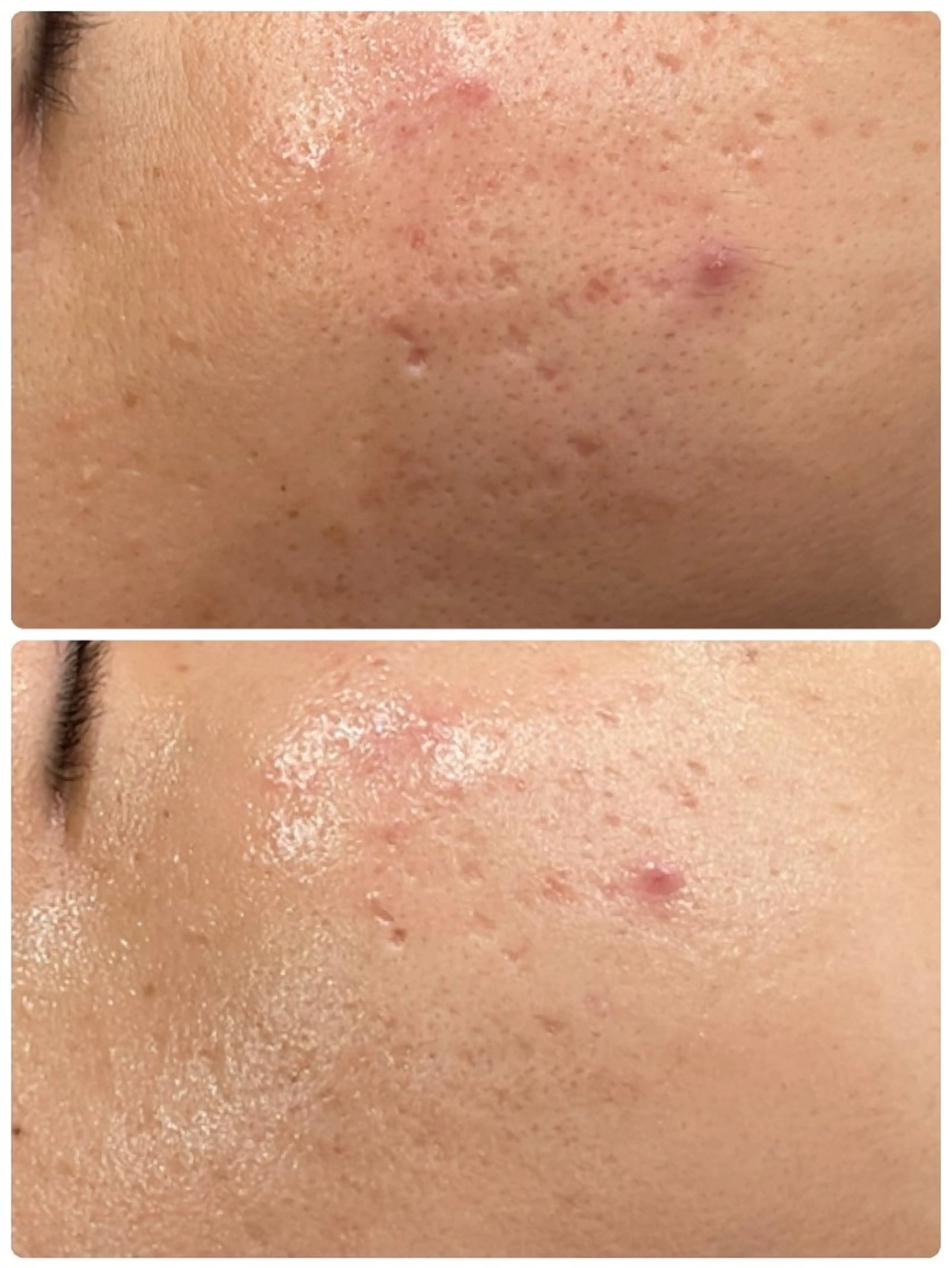 エステ TLIENGLE高宮 エステ・ネイルのエステ・リラクイメージ