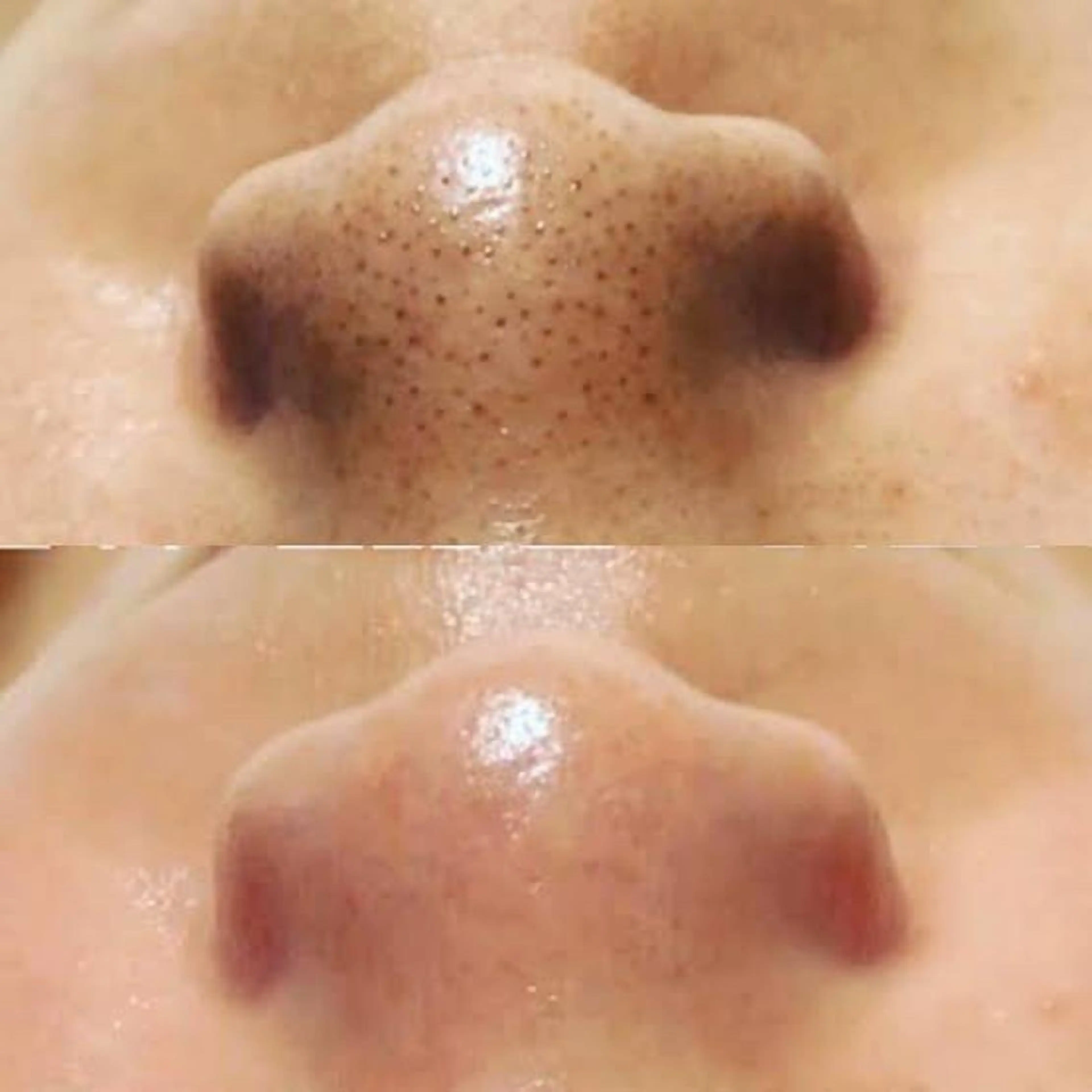 ハーブ🌿ララピール コルギ❣️坂元絵梨奈のエステ・リラクイメージ