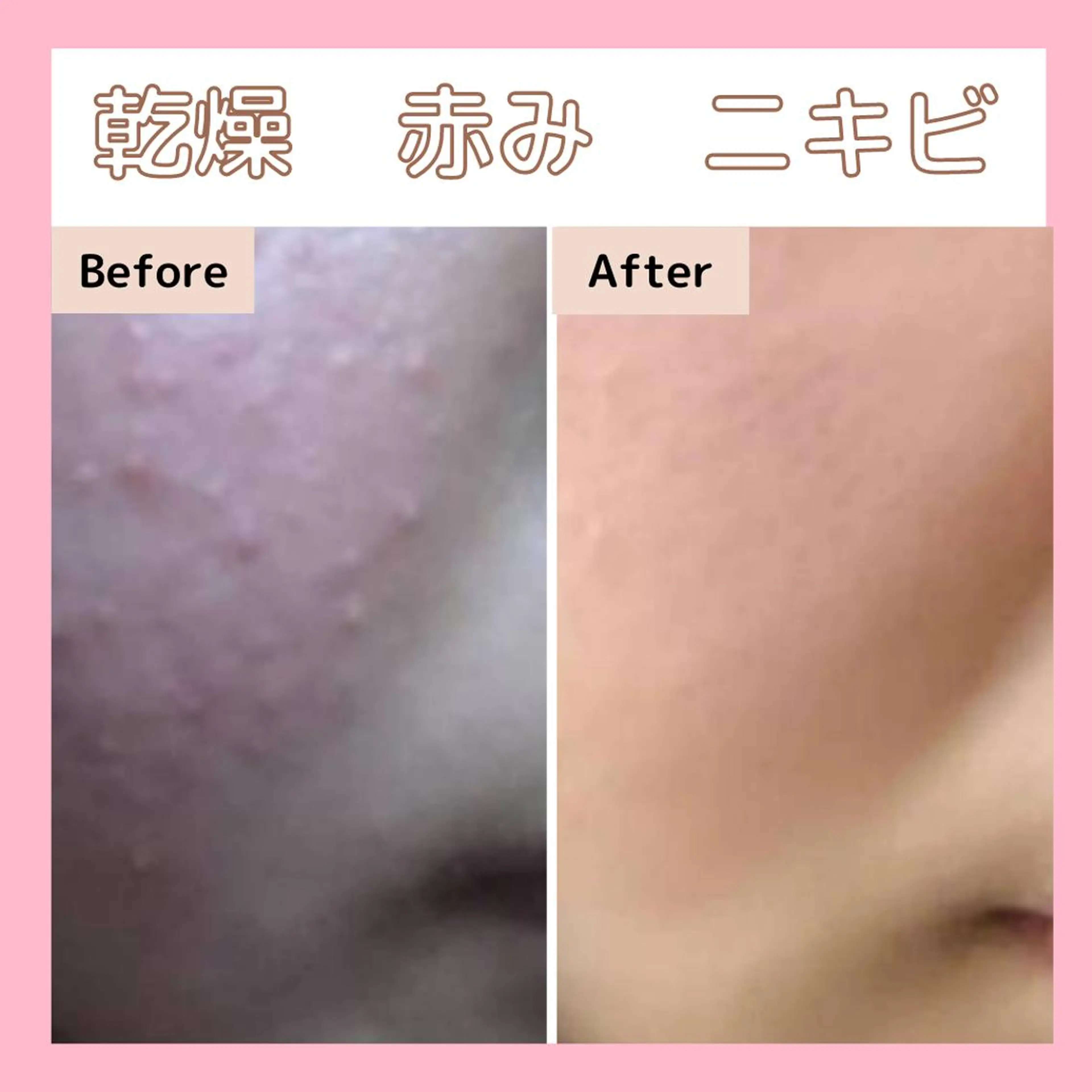 エステサロン　Sブランペタル所属・三沢市エステサロン Sブランペタルのエステ・リラクイメージ